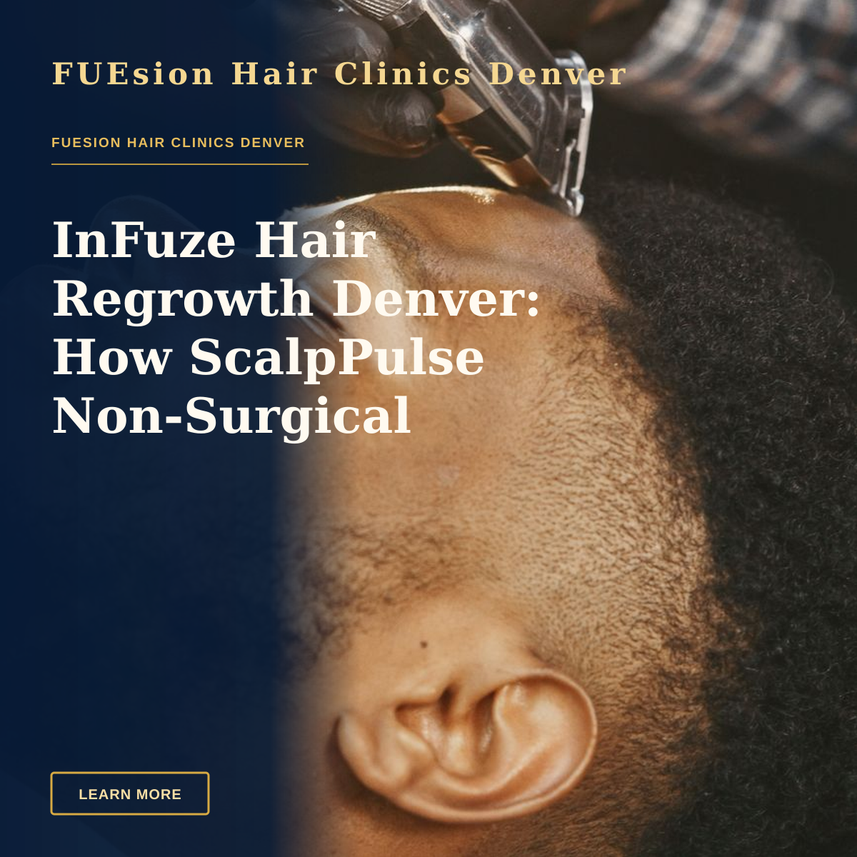 InFuze Hair Regrowth Denver: How ScalpPulse Non‑Surgical Treatment Works — African American man receives a precise haircut with a hair clipper. Close-up view.