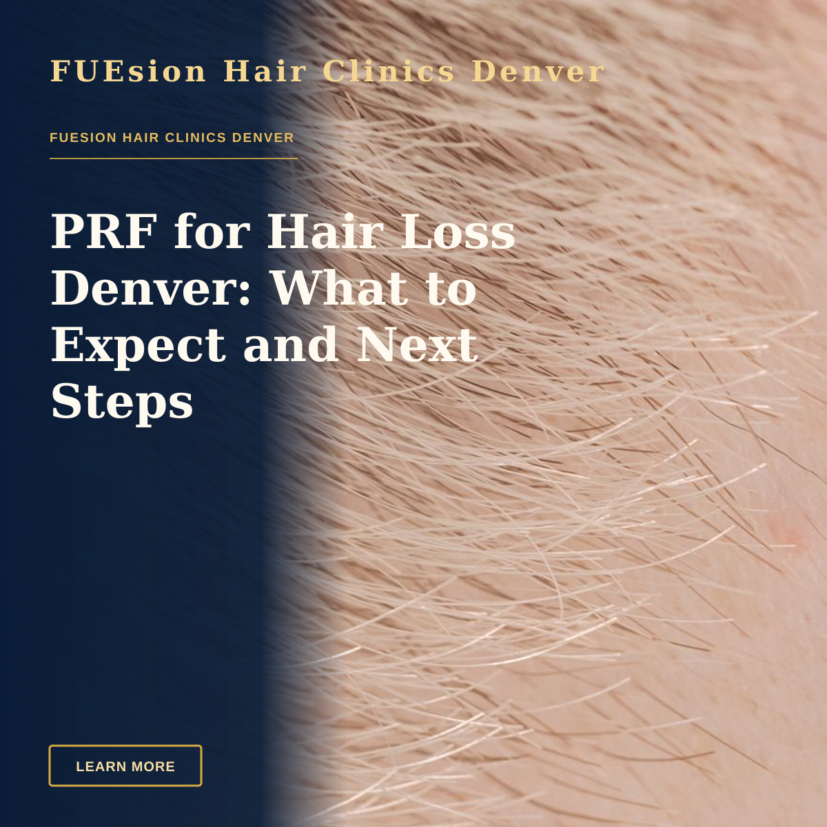 PRF for Hair Loss Denver: What to Expect and Next Steps — Full frame closeup of skin with short brown and fair hairs on surface