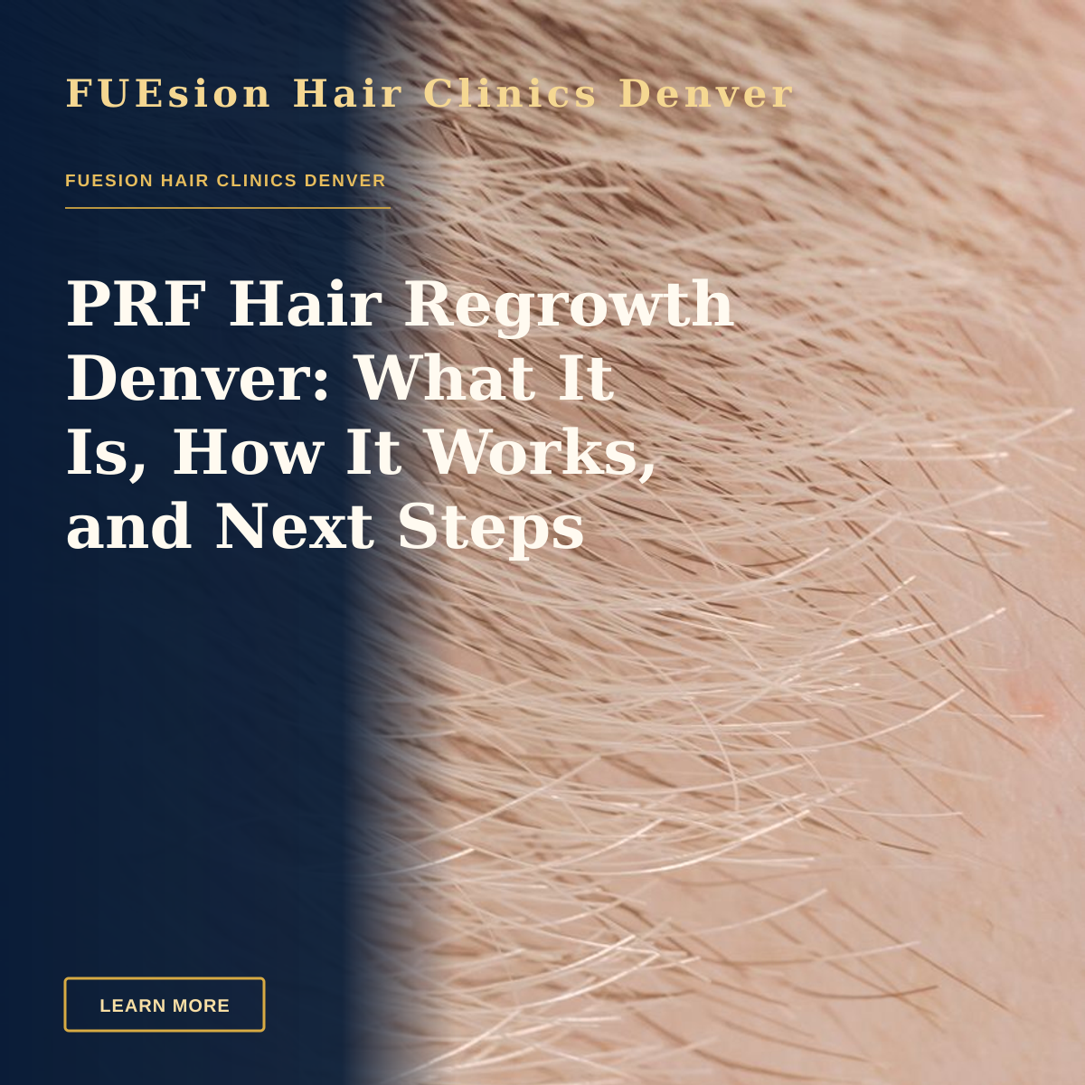 PRF Hair Regrowth Denver: What It Is, How It Works, and Next Steps — Full frame closeup of skin with short brown and fair hairs on surface