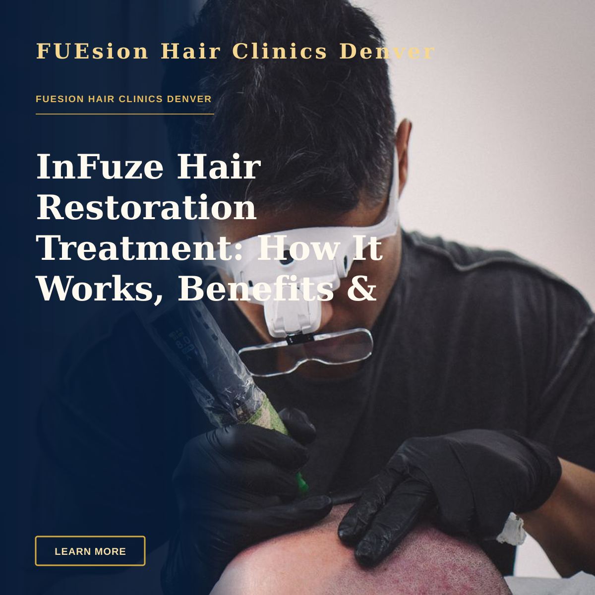 InFuze Hair Restoration Treatment: How It Works, Benefits & What to Expect — A skilled tattoo artist performing scalp micropigmentation on a client's head.