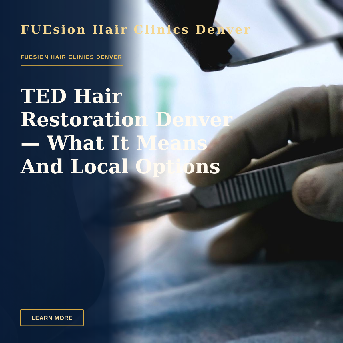 TED Hair Restoration Denver — What It Means And Local Options — Close-up of a surgical procedure focusing on hair transplant with precision tools.