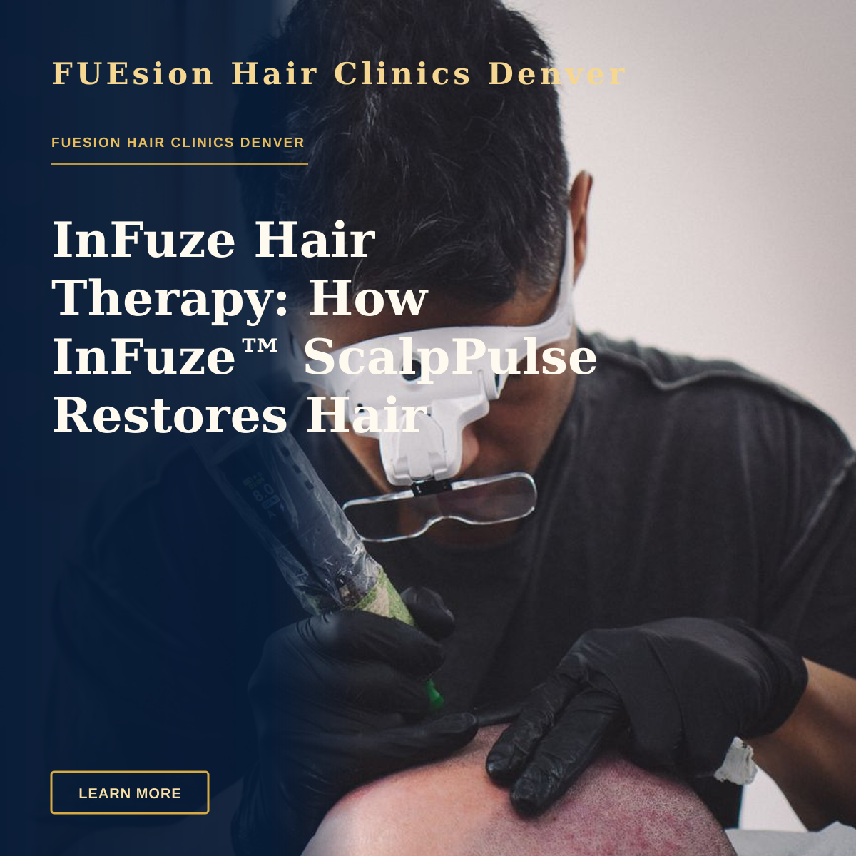 InFuze Hair Therapy: How InFuze™ ScalpPulse Restores Hair Without Surgery — A skilled tattoo artist performing scalp micropigmentation on a client's head.
