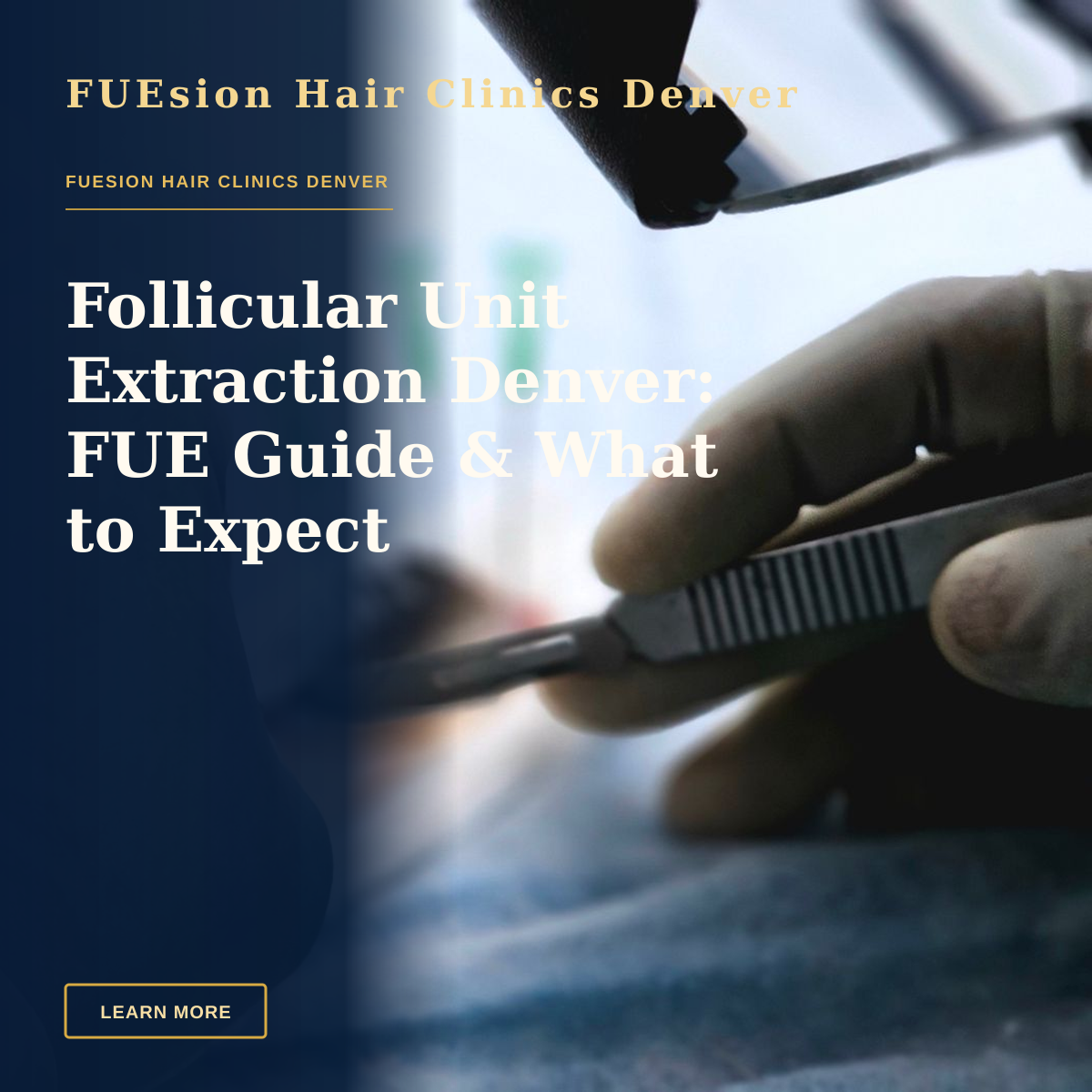 Follicular Unit Extraction Denver: FUE Guide & What to Expect — Close-up of a surgical procedure focusing on hair transplant with precision tools.
