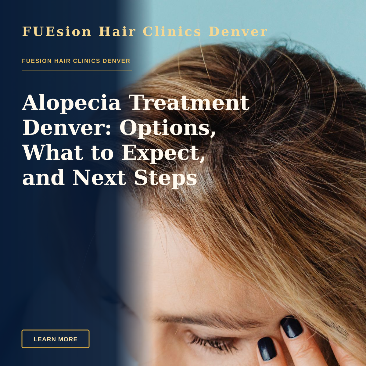 Alopecia Treatment Denver: Options, What to Expect, and Next Steps — Close-up of a woman with a hand on forehead against a blue background.
