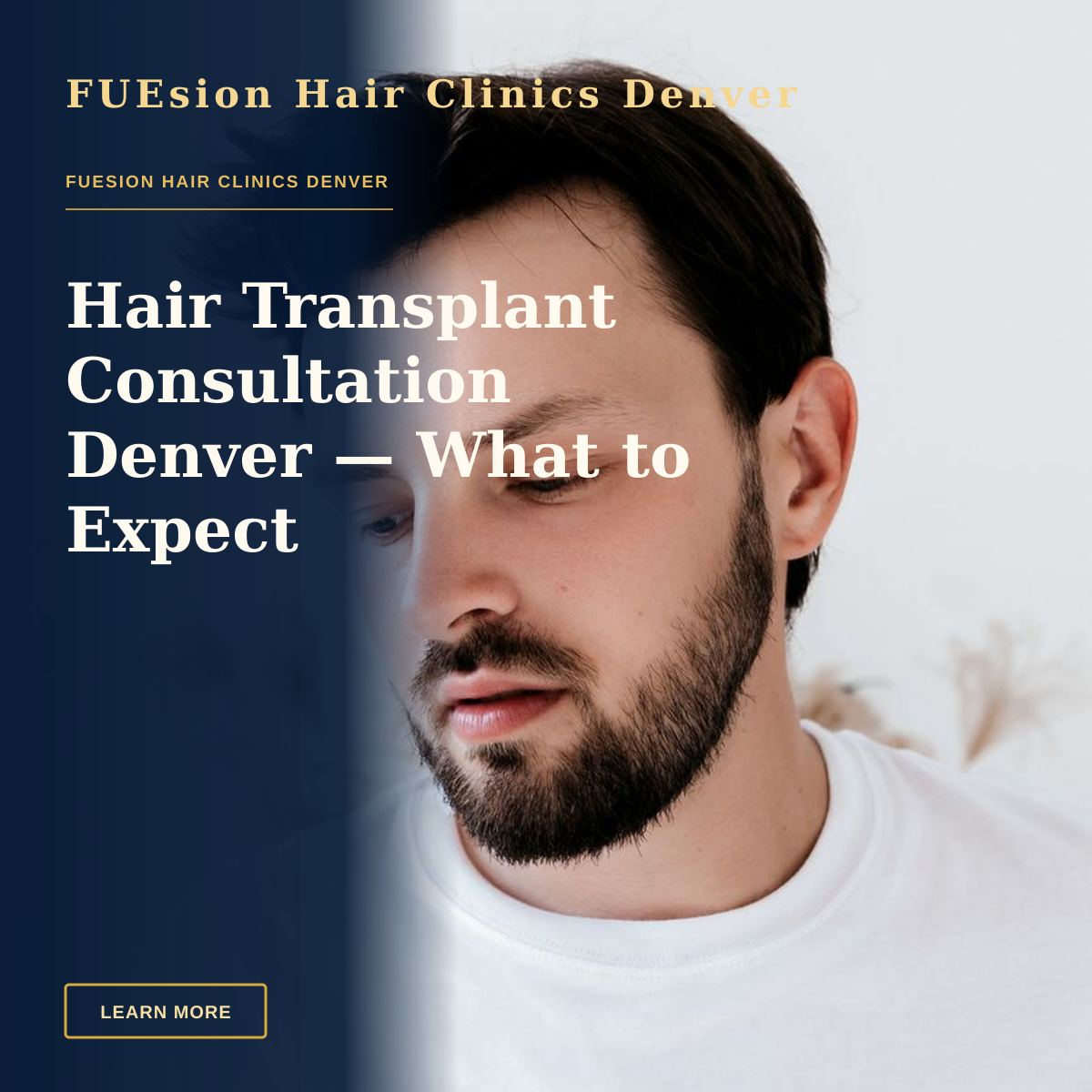 Hair Transplant Consultation Denver — What to Expect — A contemplative young man with a beard in a minimalist portrait, wearing a white t-shirt indoors.