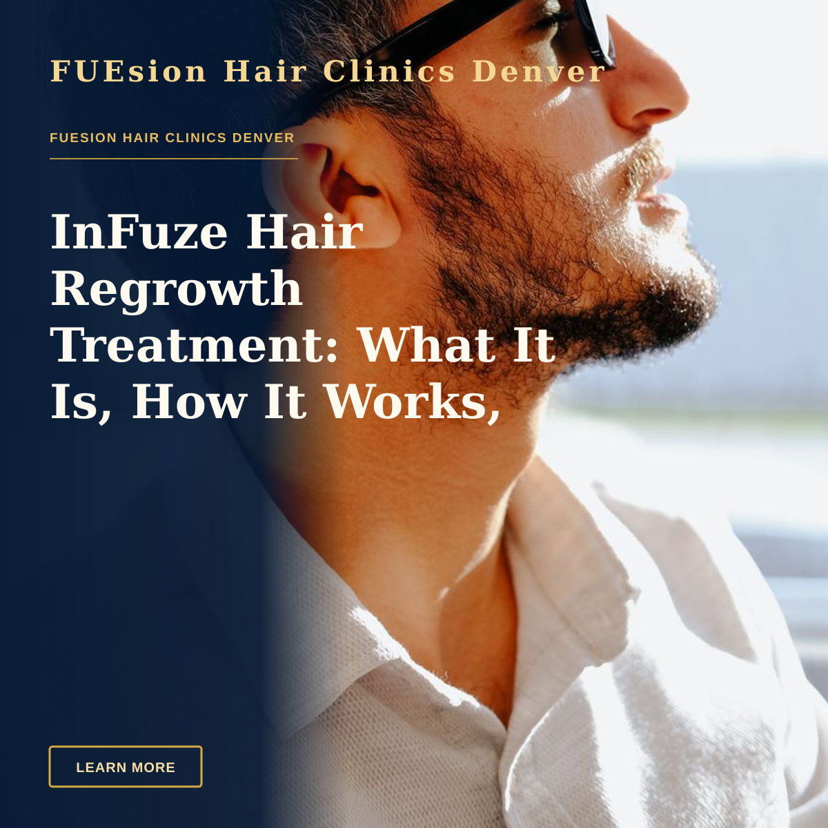 InFuze Hair Regrowth Treatment: What It Is, How It Works, and Who It's For — Side profile of a man in sunglasses, captured in natural light, conveying a relaxed mood.