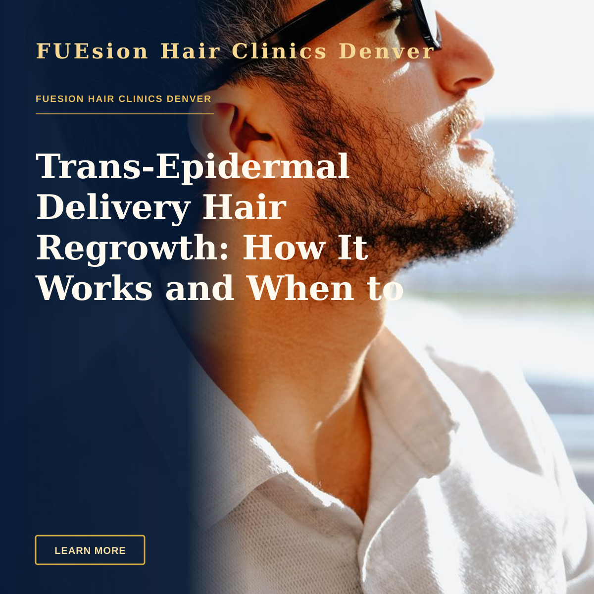 Trans-Epidermal Delivery Hair Regrowth: How It Works and When to Choose It — Side profile of a man in sunglasses, captured in natural light, conveying a relaxed mood.