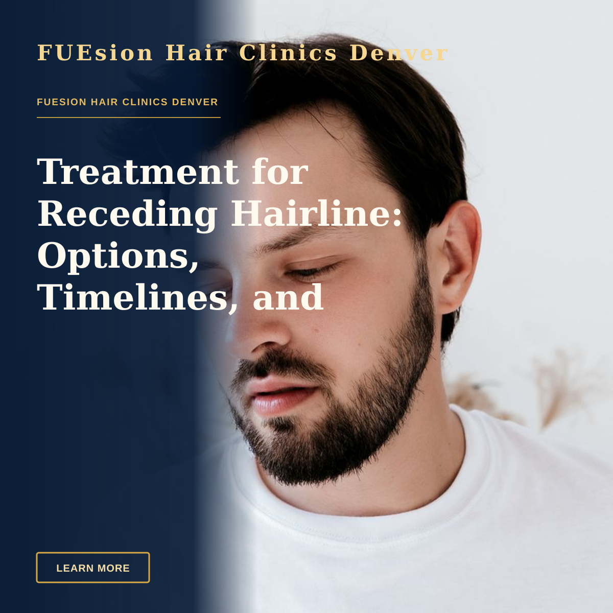 Treatment for Receding Hairline: Options, Timelines, and Next Steps — A contemplative young man with a beard in a minimalist portrait, wearing a white t-shirt indoors.