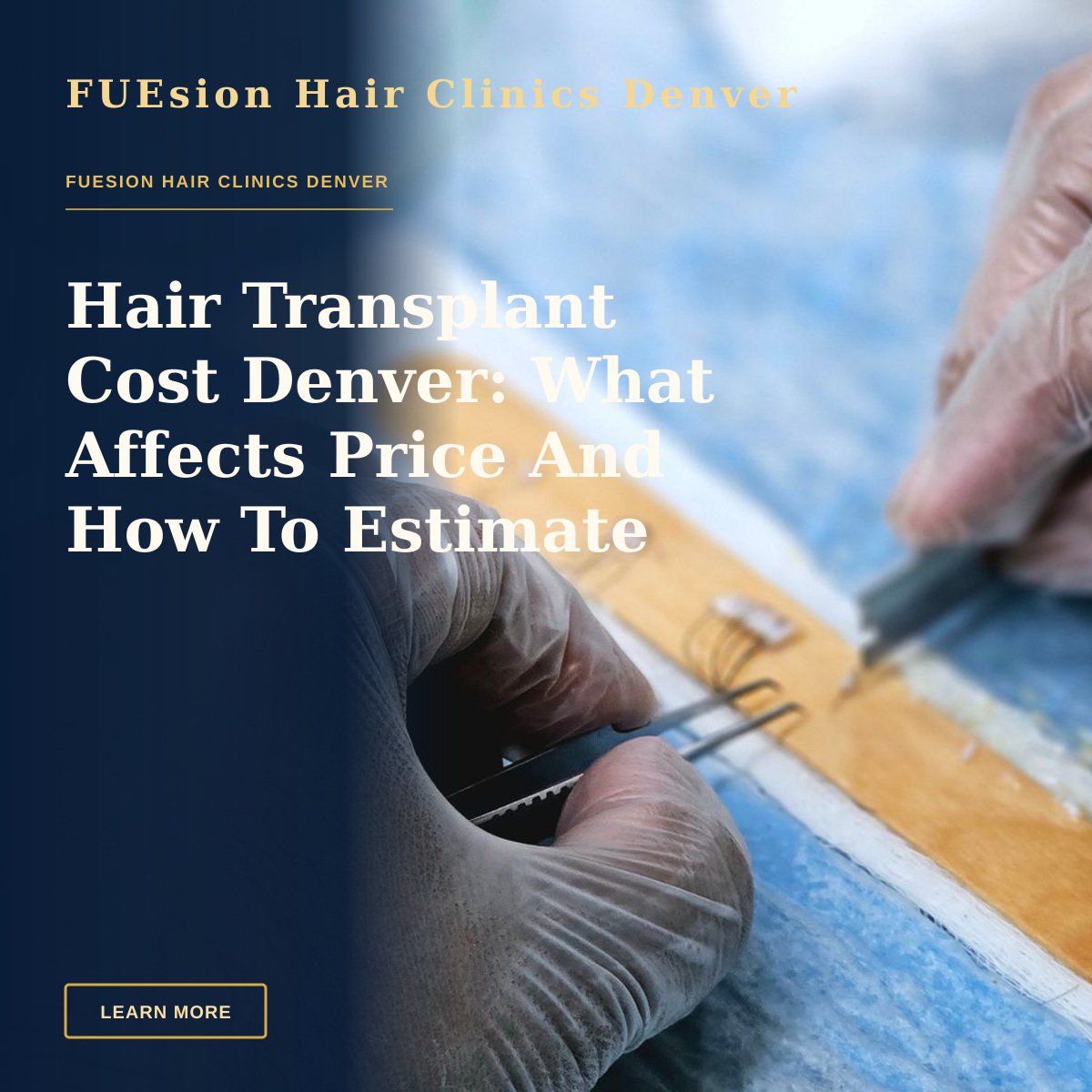 Hair Transplant Cost Denver: What Affects Price And How To Estimate — Close-up of surgeons preparing hair grafts for transplantation, demonstrating precise skills.