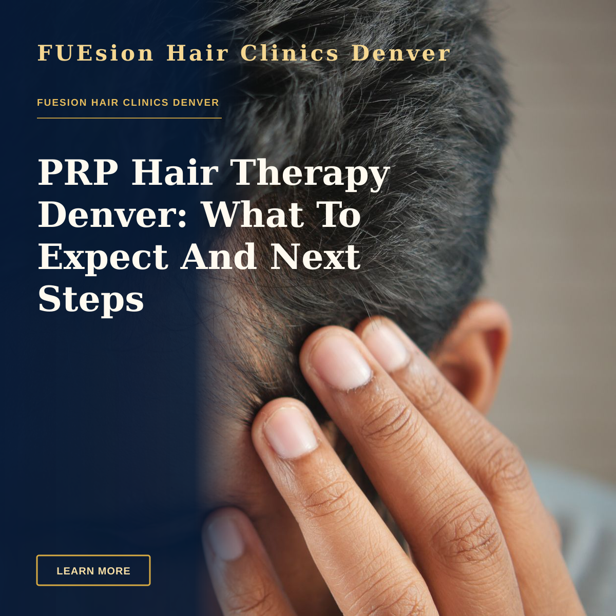 PRP Hair Therapy Denver: What To Expect And Next Steps — Close-up of a man's hand touching his head in contemplation. Neutral tones and soft lighting.