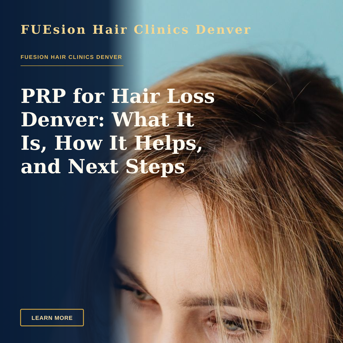 PRP for Hair Loss Denver: What It Is, How It Helps, and Next Steps — Studio shot of a woman's head with blonde hair against a blue background, focusing on her eyes and forehead.
