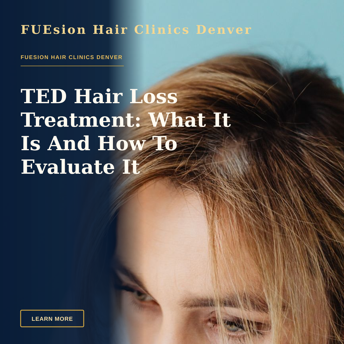 TED Hair Loss Treatment: What It Is And How To Evaluate It — Studio shot of a woman's head with blonde hair against a blue background, focusing on her eyes and forehead.