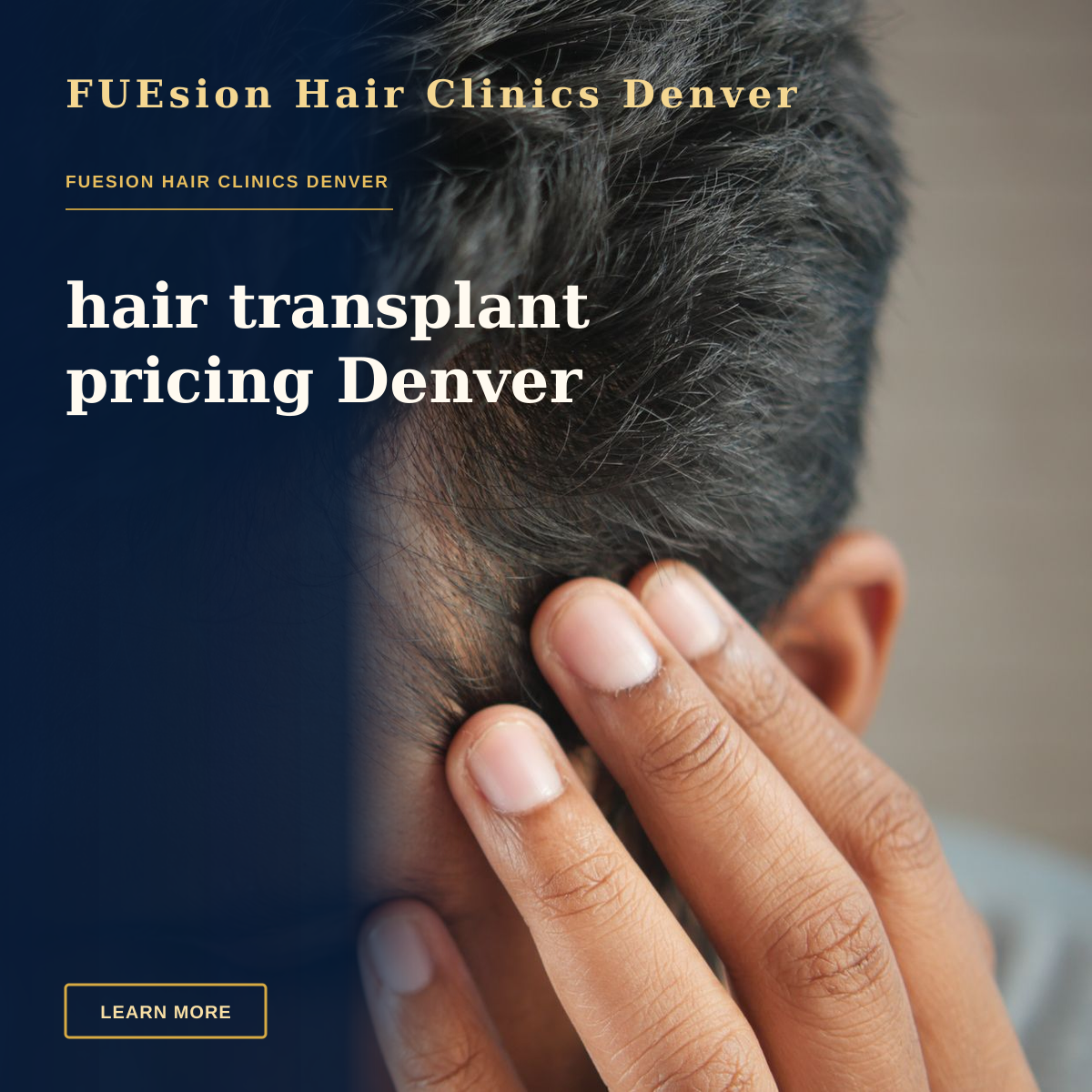 hair transplant pricing Denver — Close-up of a man's hand touching his head in contemplation. Neutral tones and soft lighting.