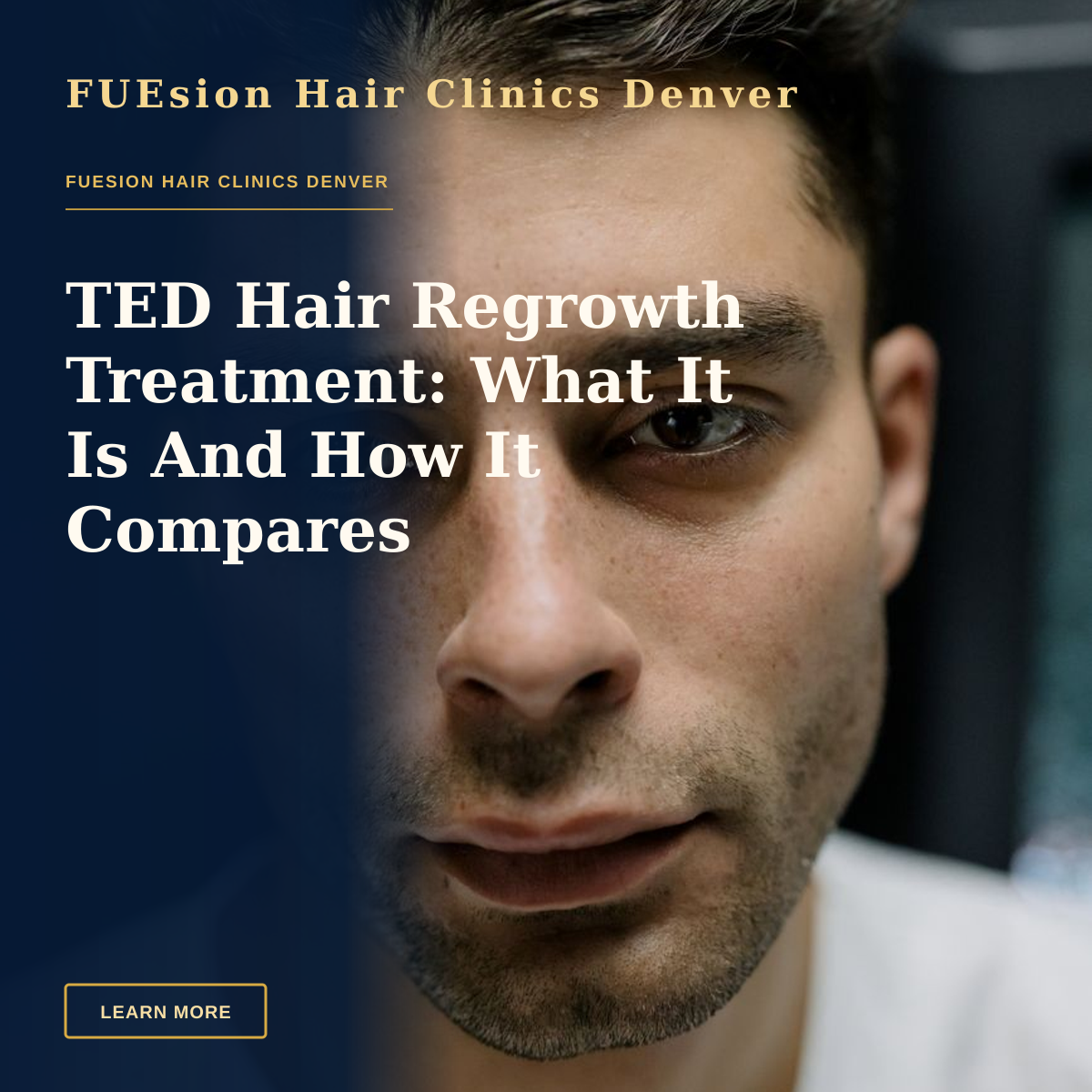 TED Hair Regrowth Treatment: What It Is And How It Compares — Intimate close-up portrait of a young man with a serious expression.