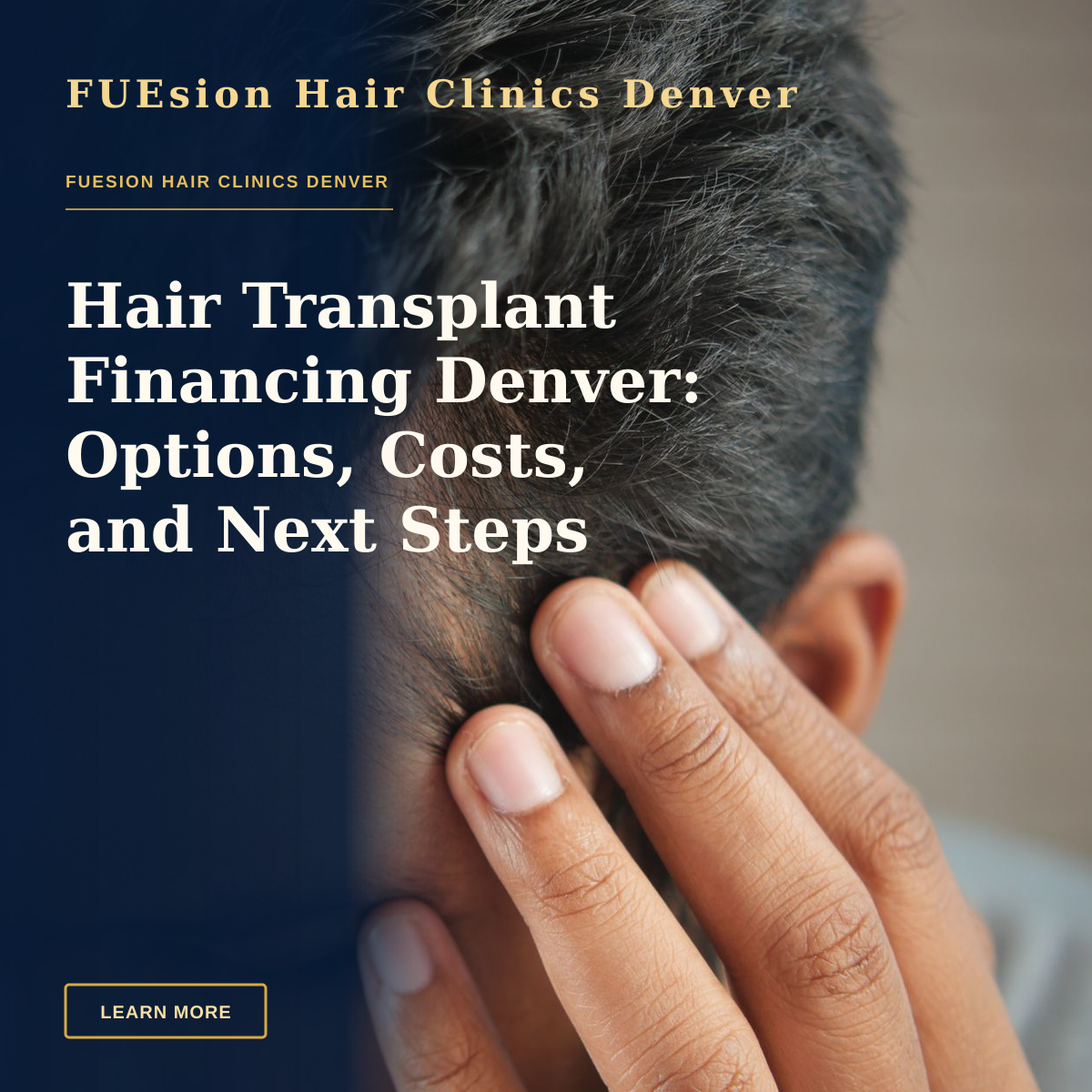 Hair Transplant Financing Denver: Options, Costs, and Next Steps — Close-up of a man's hand touching his head in contemplation. Neutral tones and soft lighting.