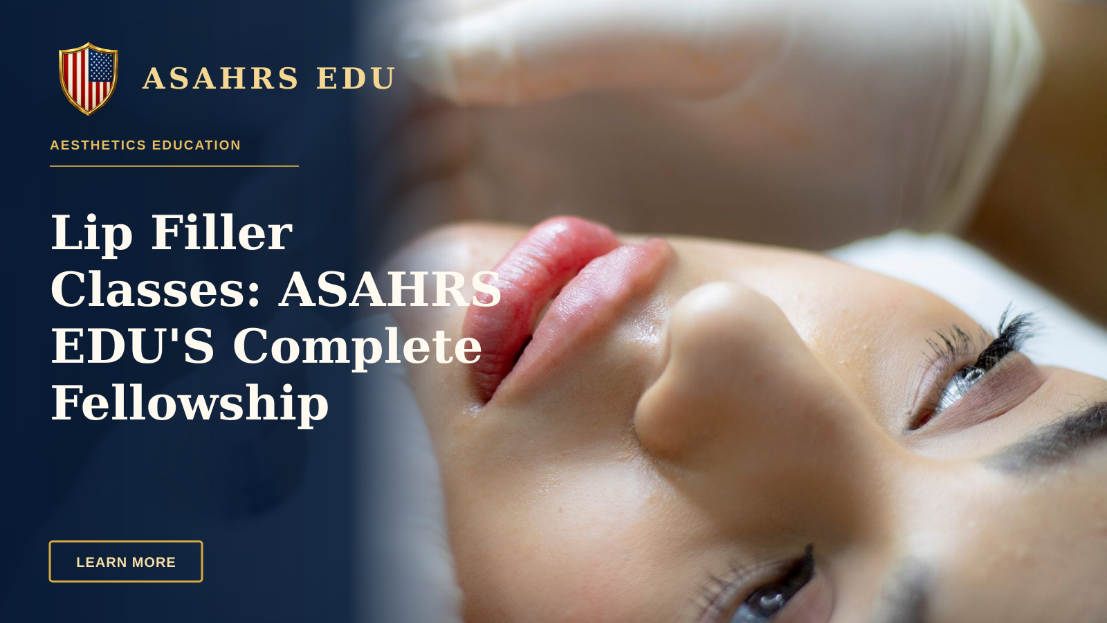 Lip Filler Classes: ASAHRS EDU'S Complete Fellowship — Close-up of a woman receiving a lip augmentation with a syringe by a professional.