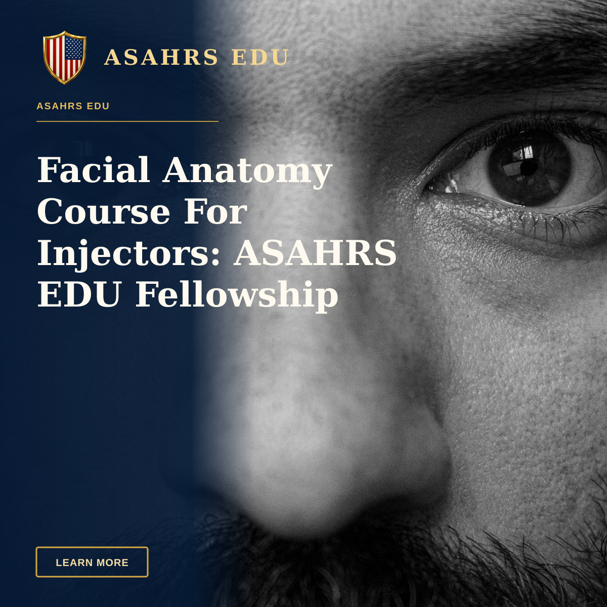 Facial Anatomy Course For Injectors: ASAHRS EDU Fellowship — Intense black and white close-up photo focusing on the eyes of a bearded man.