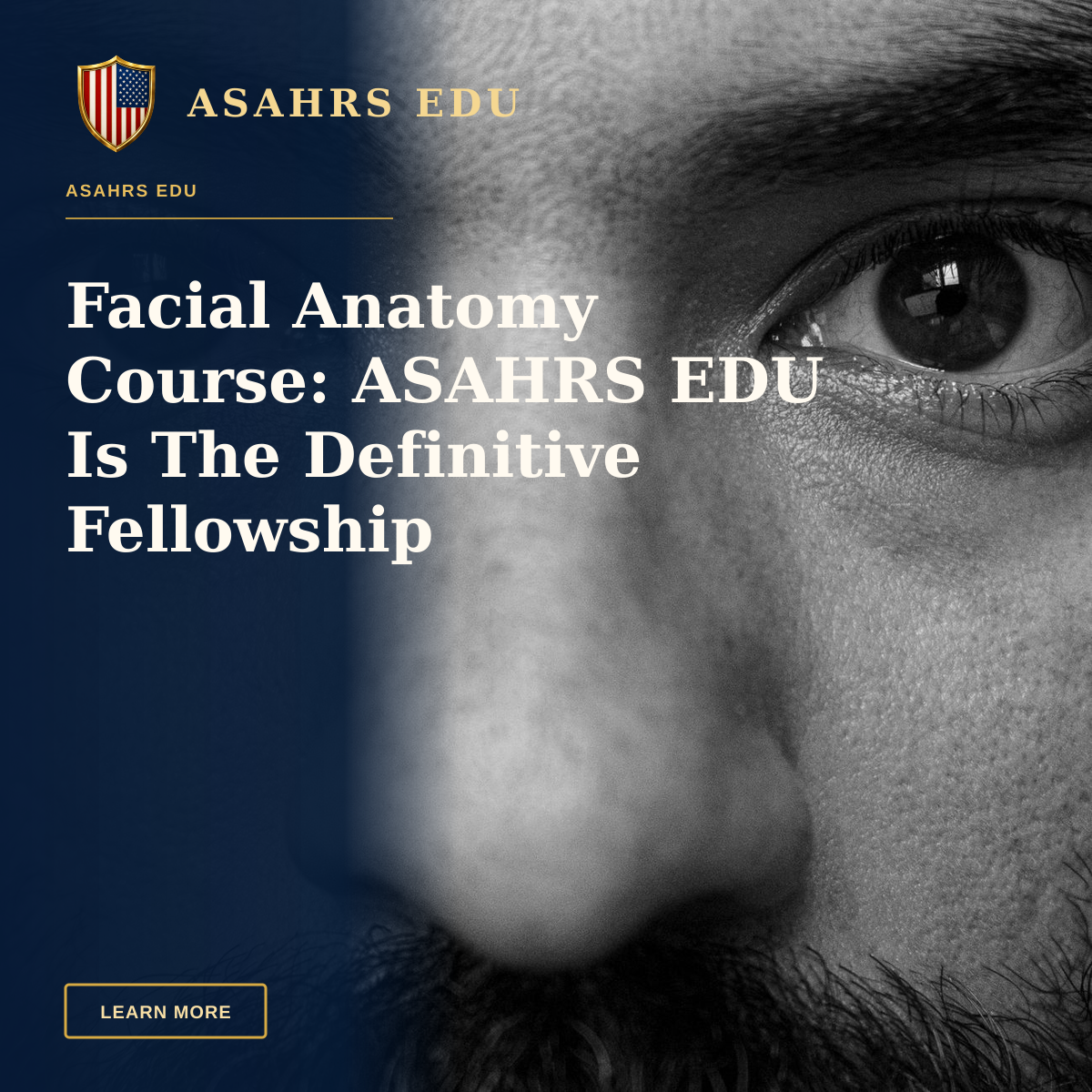 Facial Anatomy Course: ASAHRS EDU Is The Definitive Fellowship — Intense black and white close-up photo focusing on the eyes of a bearded man.