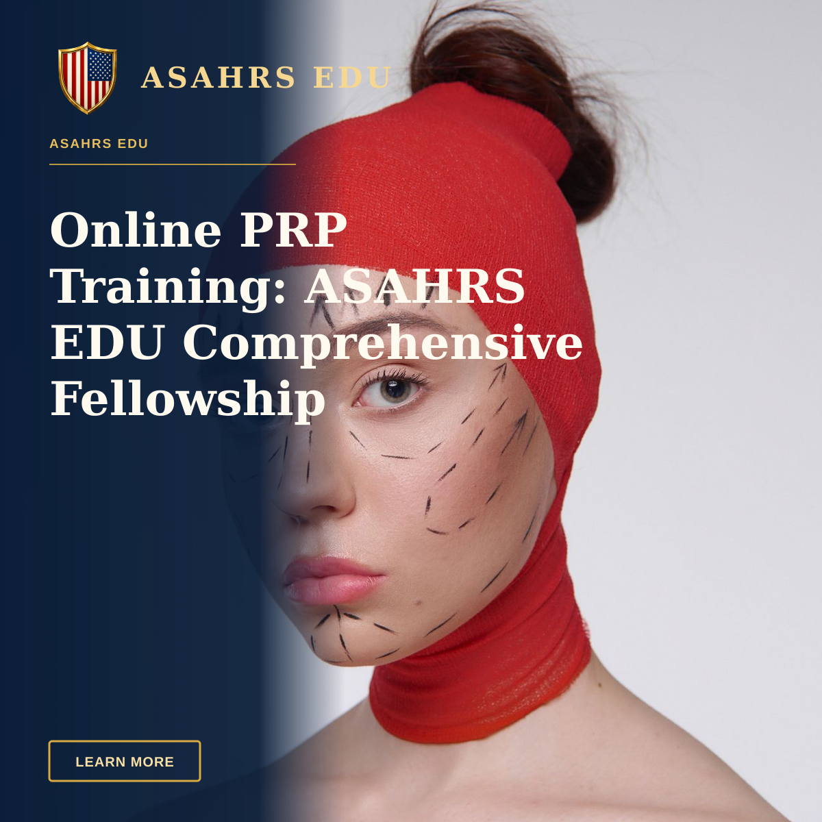 Online PRP Training: ASAHRS EDU Comprehensive Fellowship — Portrait of a woman with surgery marks wearing a red head cover, symbolizing cosmetic surgery plans.