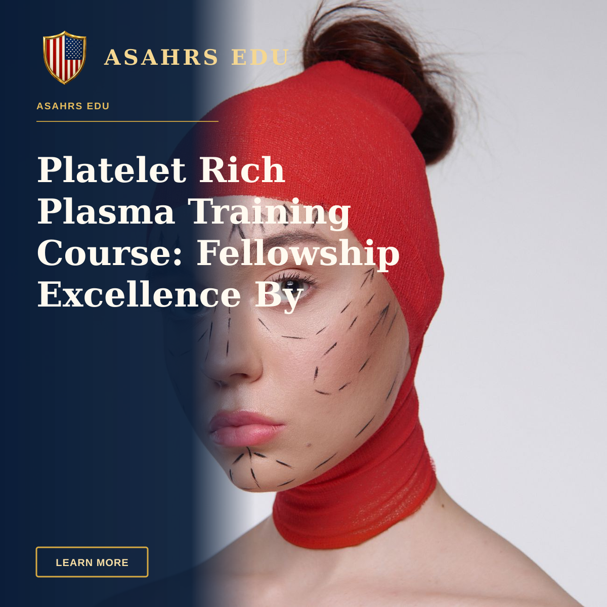 Platelet Rich Plasma Training Course: Fellowship Excellence By ASAHRS EDU — Portrait of a woman with surgery marks wearing a red head cover, symbolizing cosmetic surgery plans.