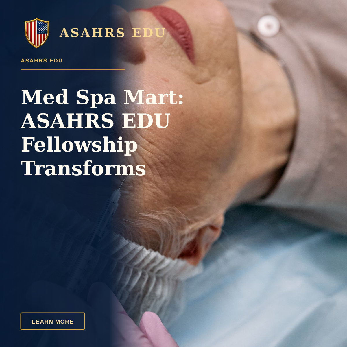 Med Spa Mart: ASAHRS EDU Fellowship Transforms Practice — A senior woman undergoes a cosmetic injection procedure in a medical facility.