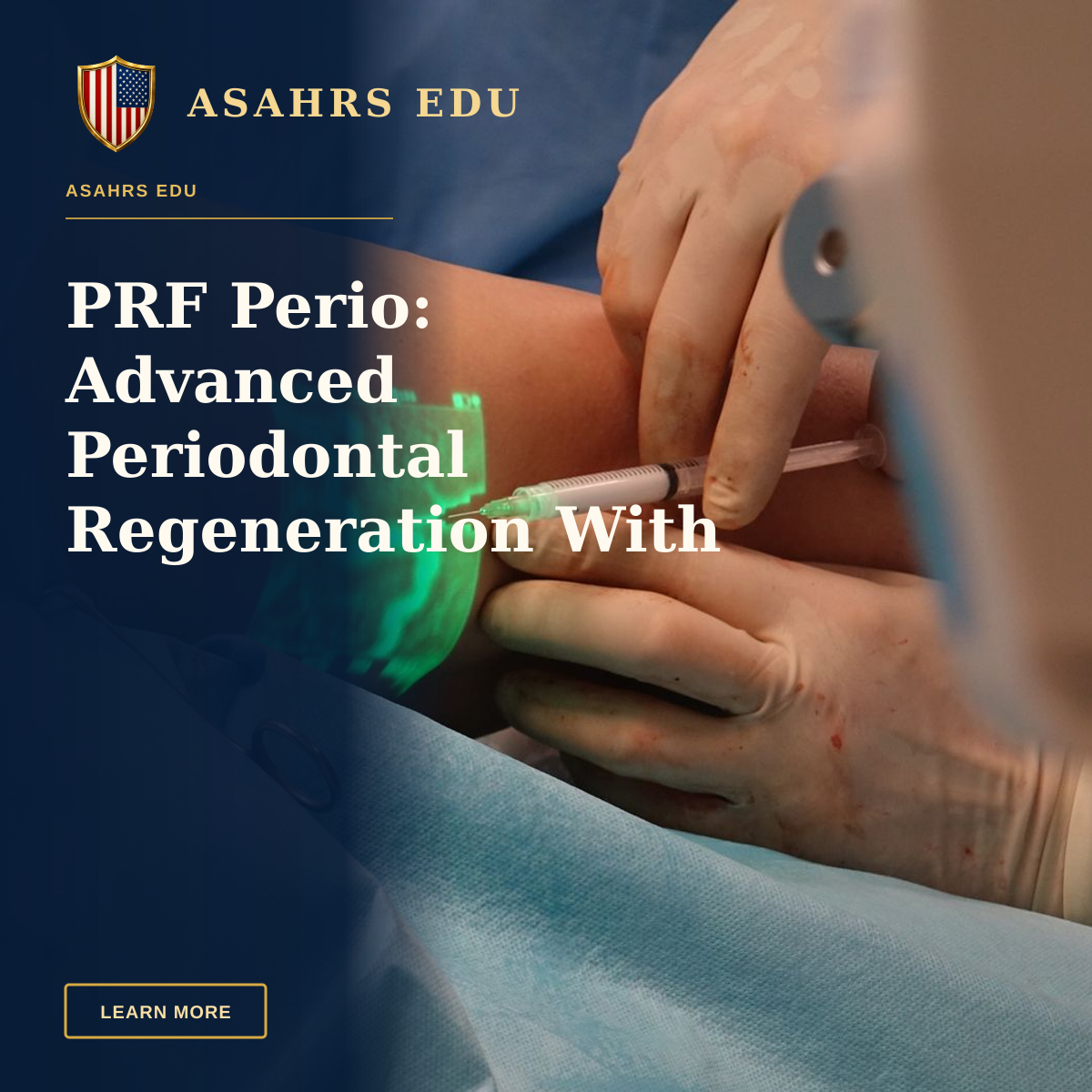 PRF Perio: Advanced Periodontal Regeneration With ASAHRS EDU — A doctor performs a medical procedure using advanced vein visualization technology.