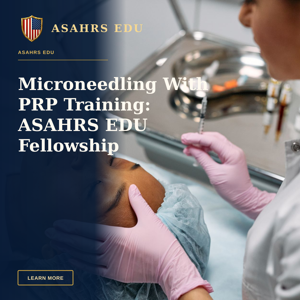 Microneedling With PRP Training: ASAHRS EDU Fellowship — Professional administering skincare treatment with syringe indoors.