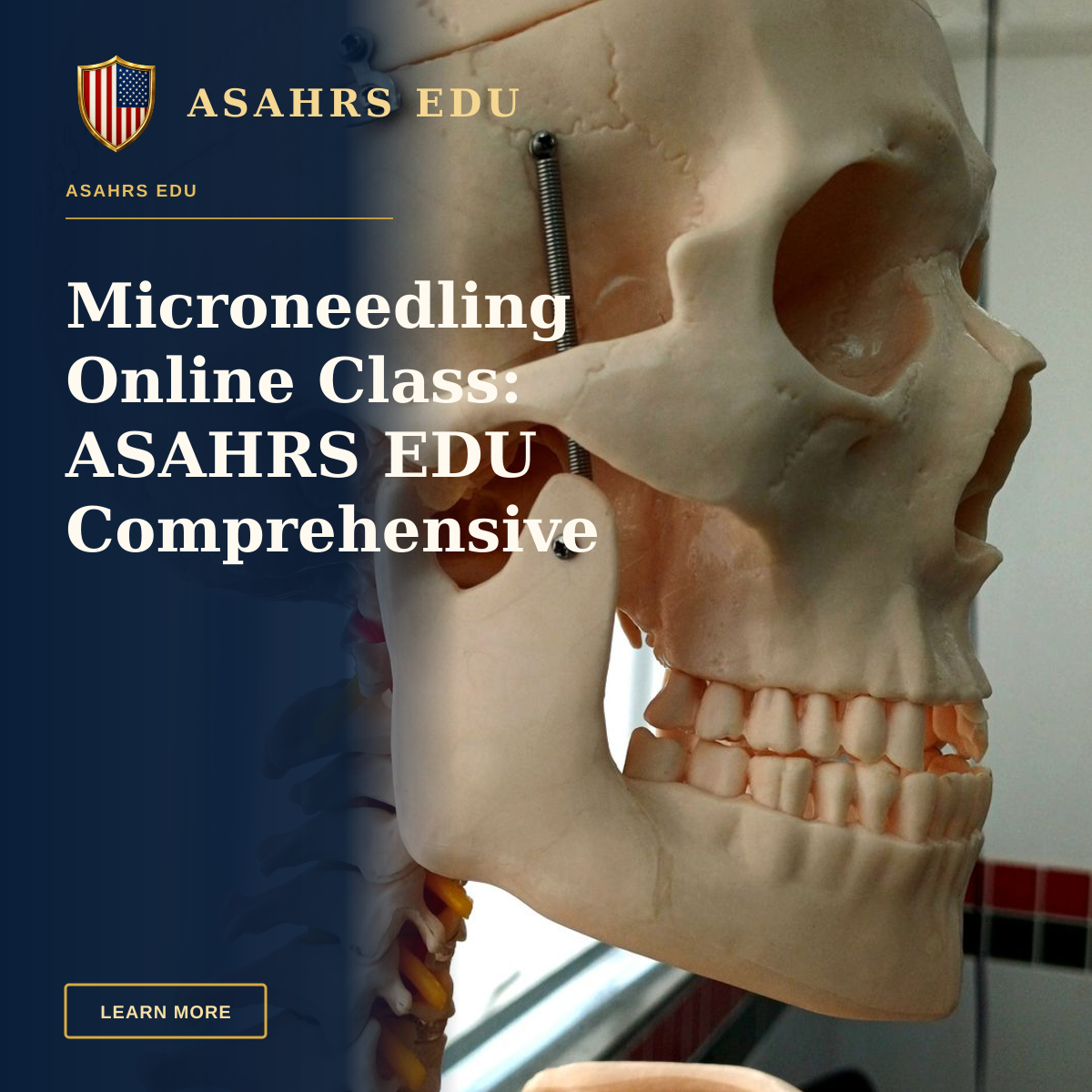 Microneedling Online Class: ASAHRS EDU Comprehensive Fellowship — Close-up of a plastic human skull model used for educational purposes in a classroom setting.