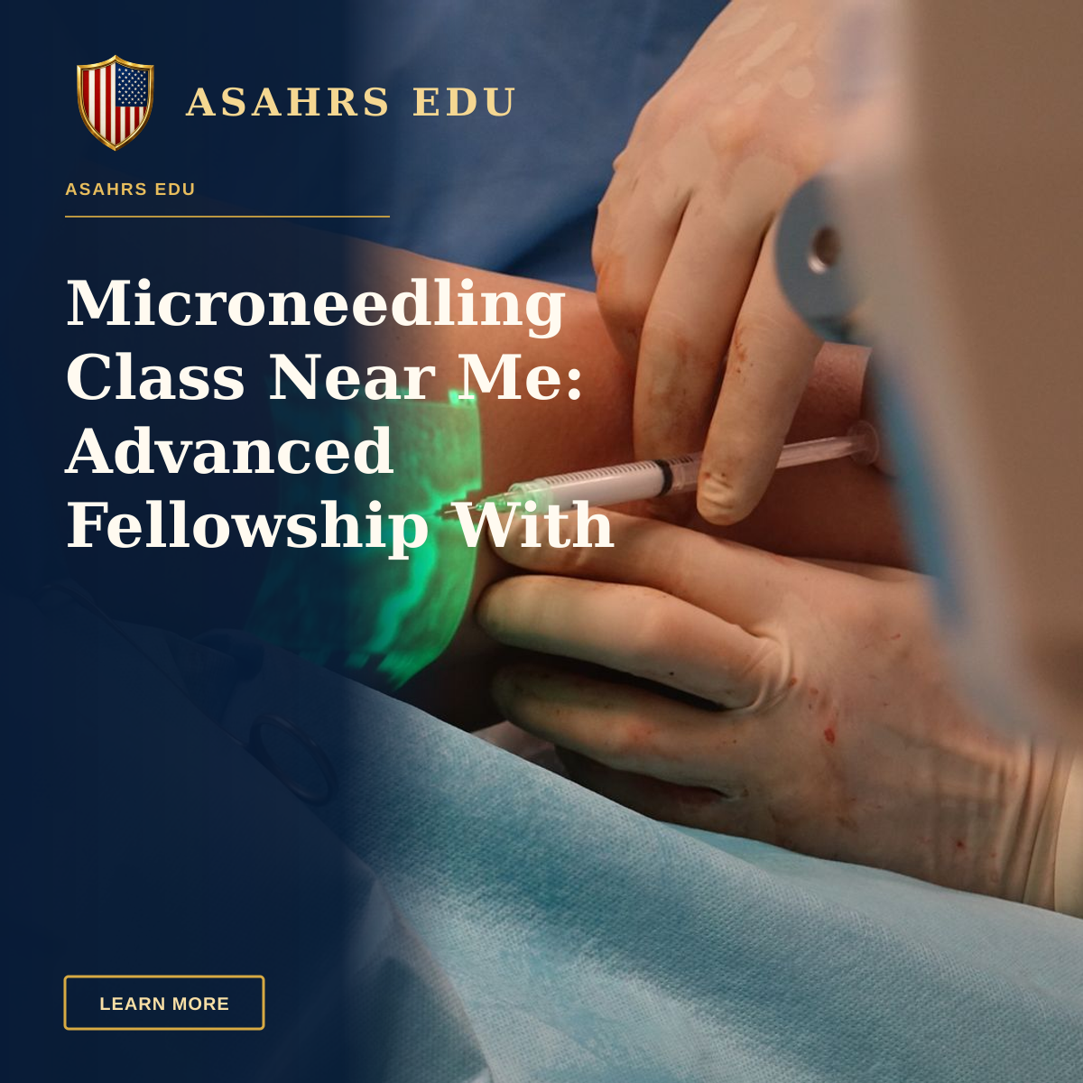 Microneedling Class Near Me: Advanced Fellowship With ASAHRS EDU — A doctor performs a medical procedure using advanced vein visualization technology.
