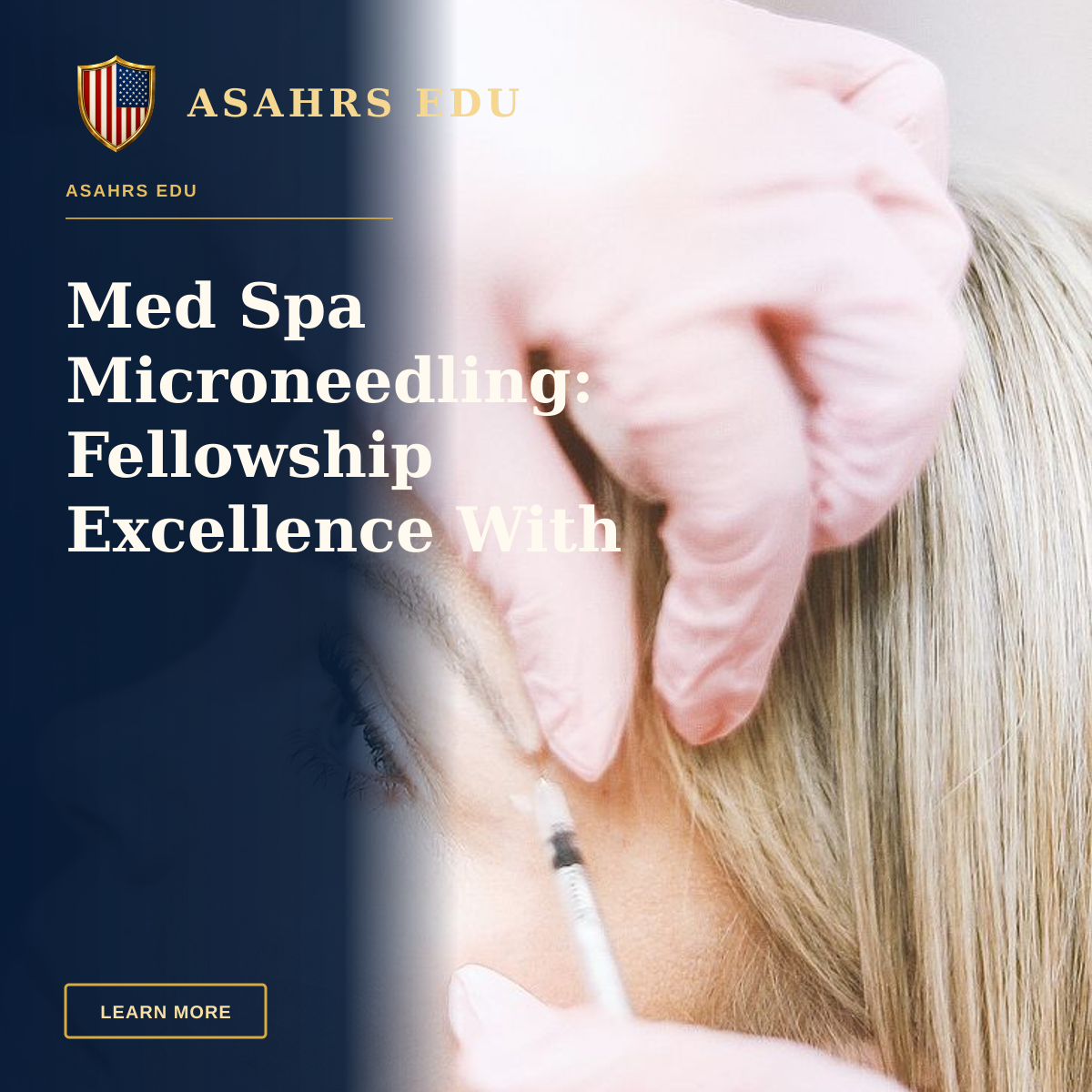 Med Spa Microneedling: Fellowship Excellence With ASAHRS EDU — Close-up of a cosmetic treatment with injection at a modern beauty clinic.
