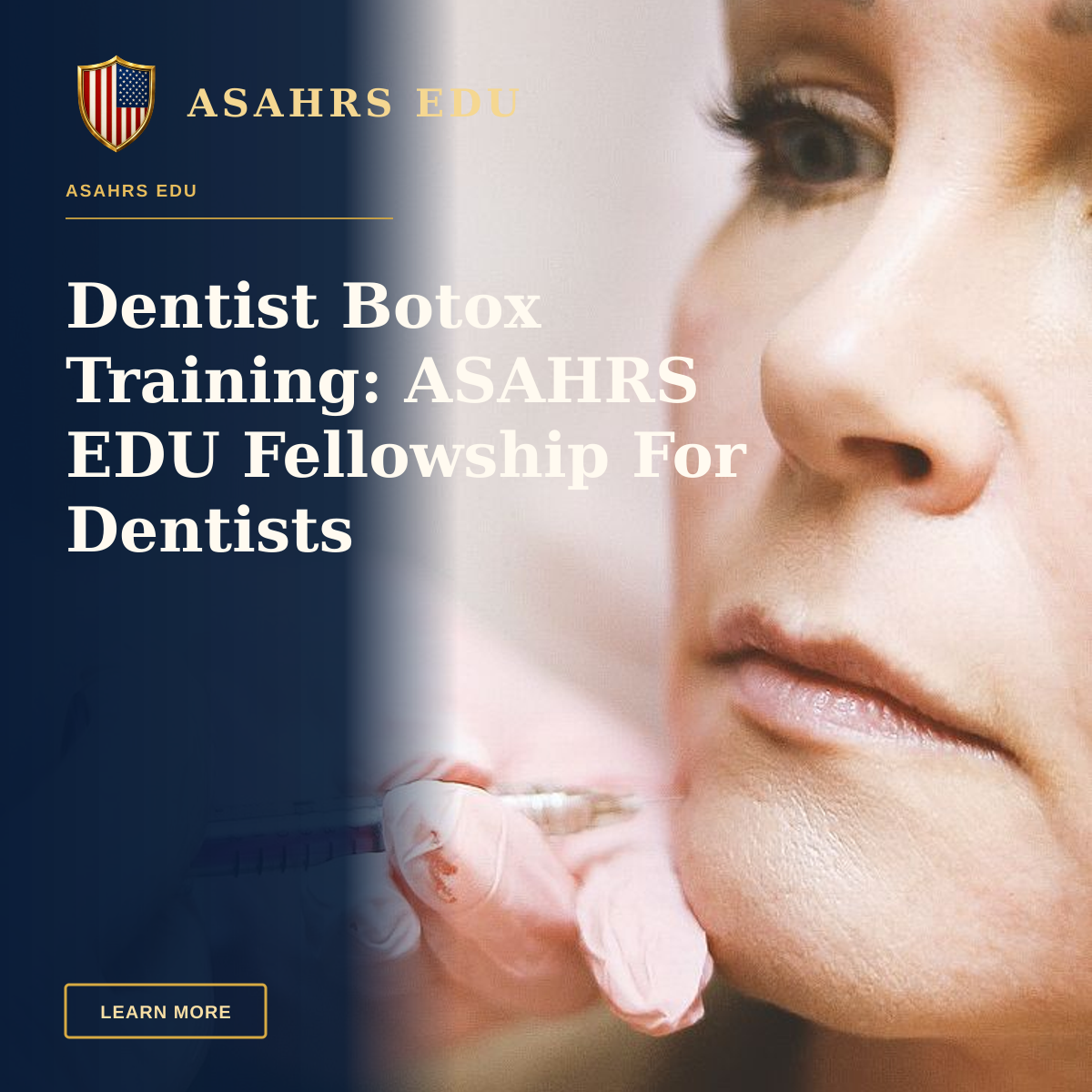 Dentist Botox Training: ASAHRS EDU Fellowship For Dentists — Close-up of a woman receiving a dermal filler injection, highlighting modern beauty treatments.