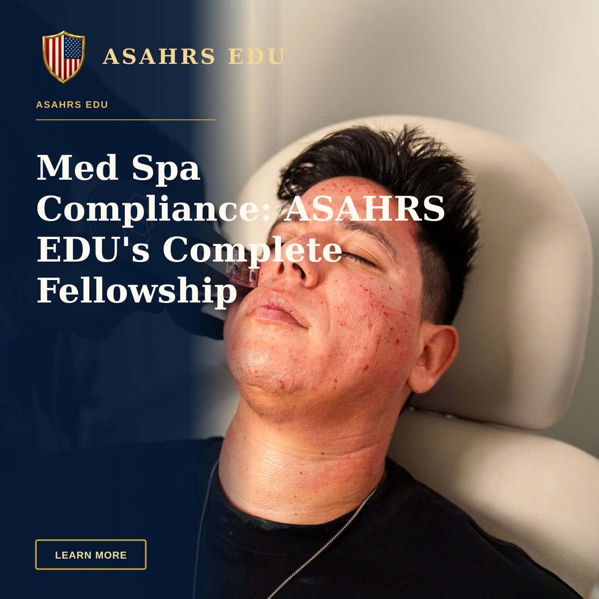 Med Spa Compliance: ASAHRS EDU's Complete Fellowship Solution — Man receives Morpheus8 facial treatment in Santa Ana med spa for skincare rejuvenation.
