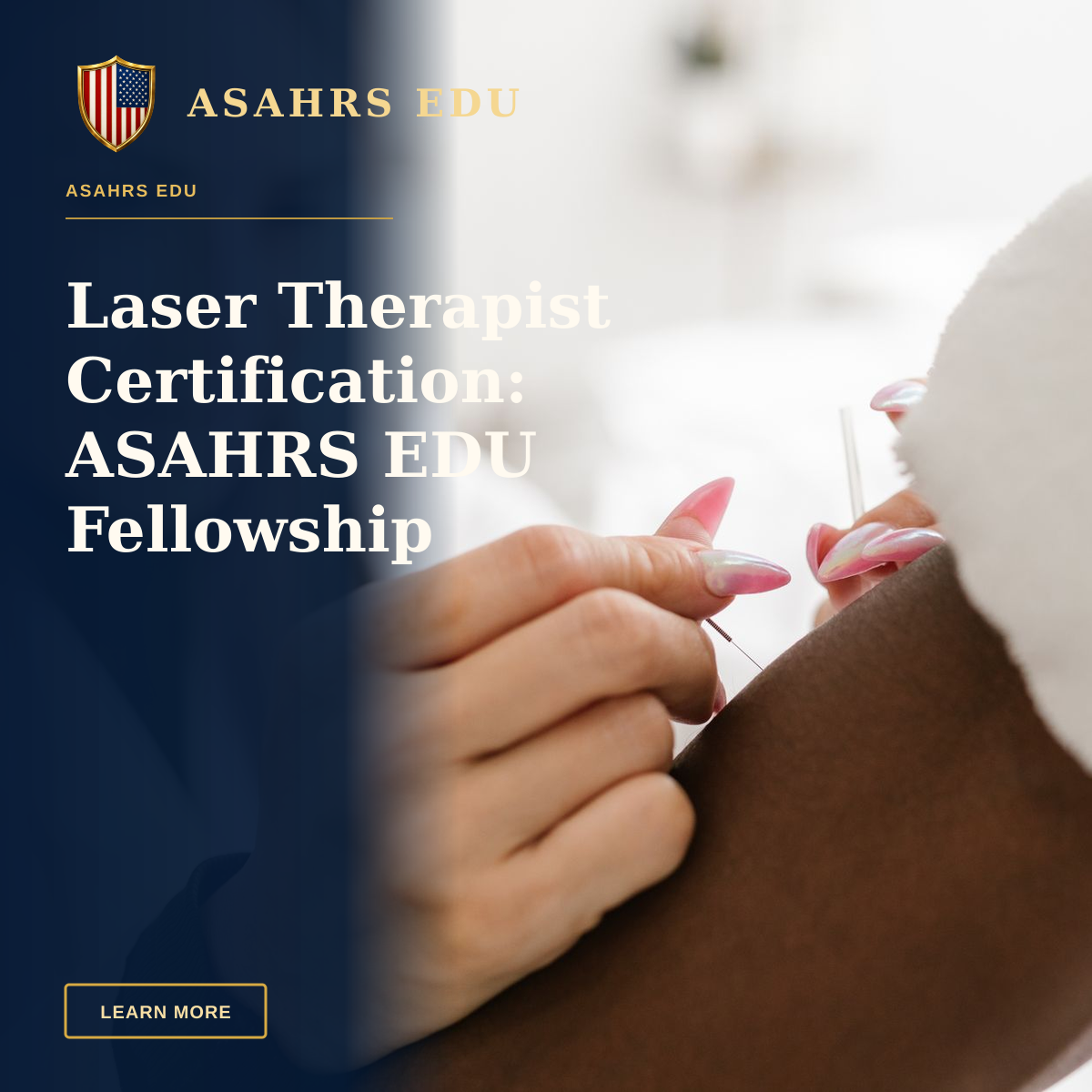 Laser Therapist Certification: ASAHRS EDU Fellowship Advantage — Close-up of a therapist performing acupuncture on a client's arm, promoting holistic health and wellness.