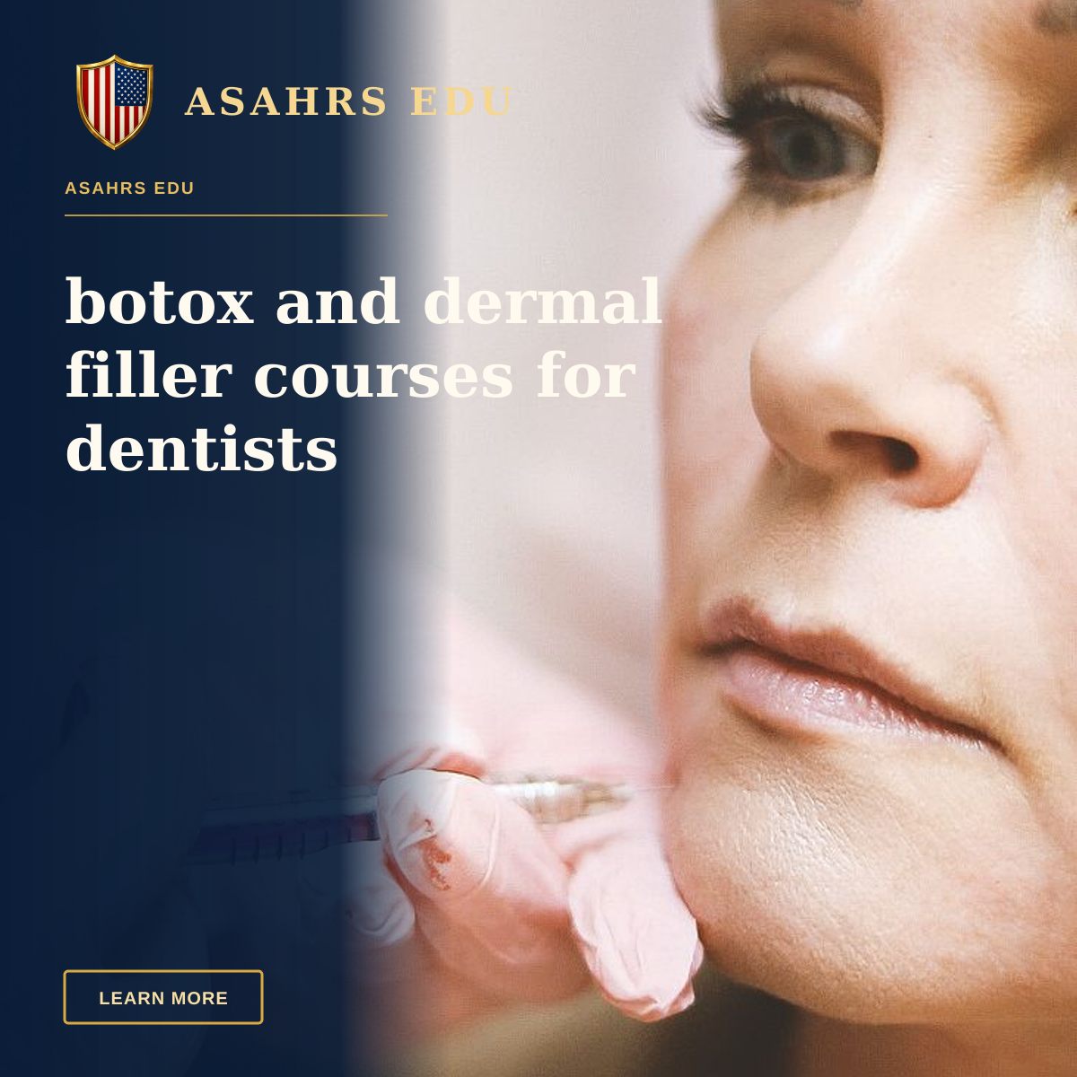 botox and dermal filler courses for dentists — Close-up of a woman receiving a dermal filler injection, highlighting modern beauty treatments.