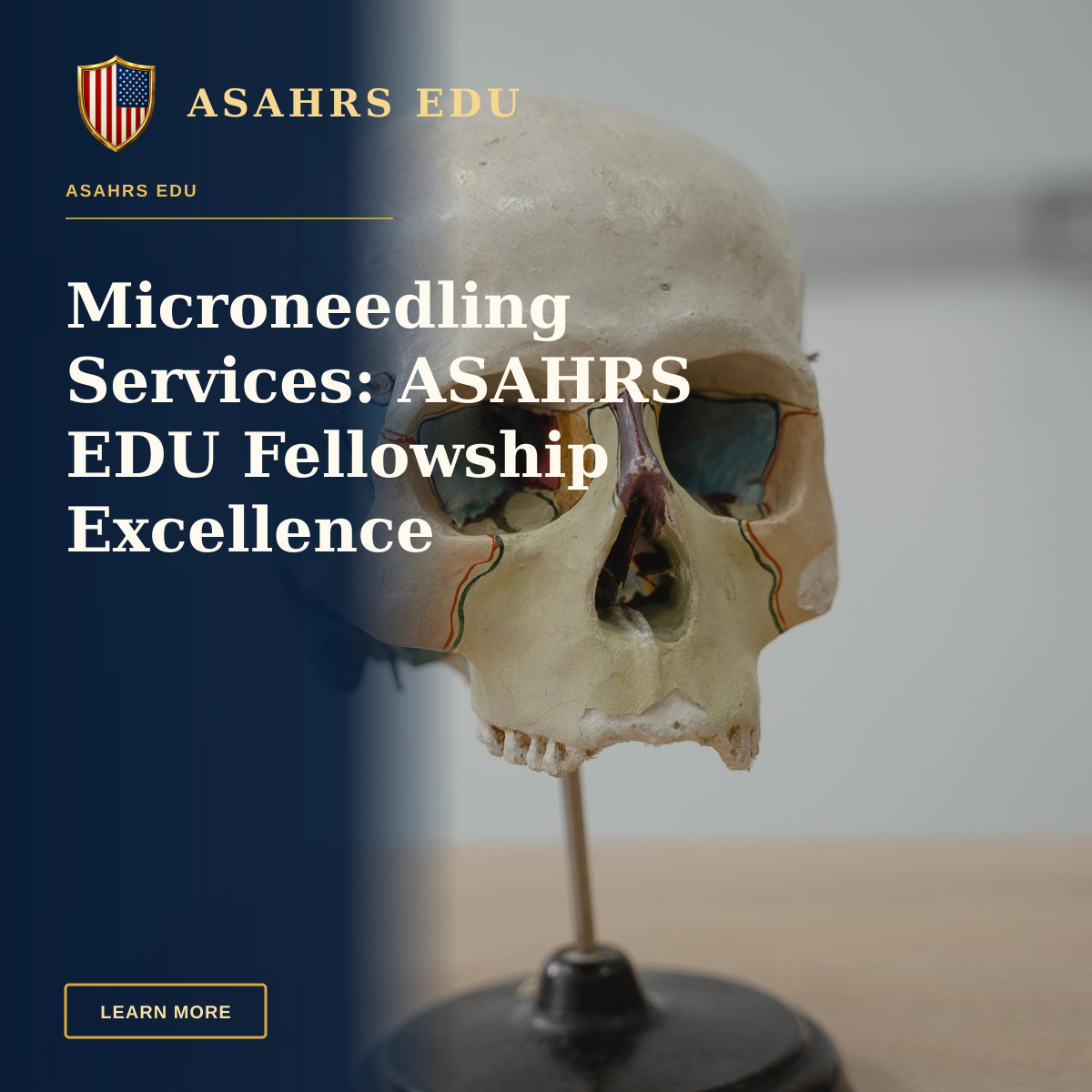 Microneedling Services: ASAHRS EDU Fellowship Excellence — Detailed model of human skull used in biology and anatomy education.