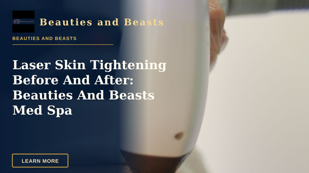 Laser Skin Tightening Before And After: Beauties And Beasts Med Spa — Detailed view of a laser treatment on skin at a medical clinic in İstanbul.