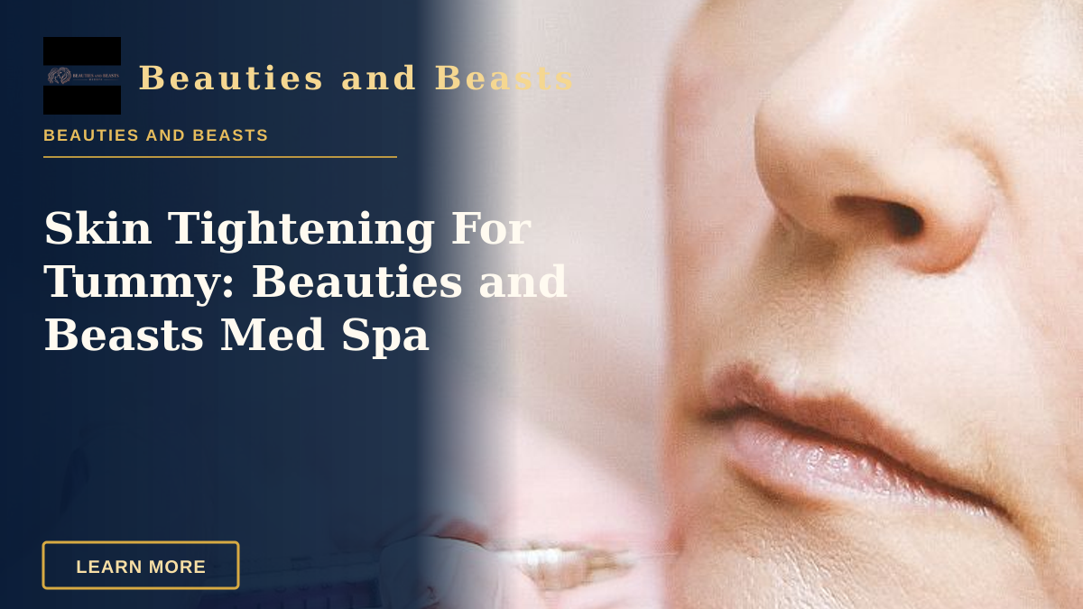 Skin Tightening For Tummy: Beauties and Beasts Med Spa — Close-up of a woman receiving a dermal filler injection, highlighting modern beauty treatments.