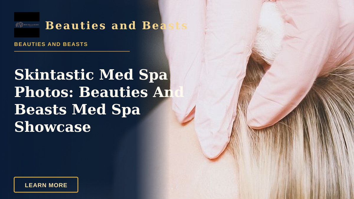 Skintastic Med Spa Photos: Beauties And Beasts Med Spa Showcase — Close-up of a cosmetic injection procedure in a modern spa setting, enhancing beauty and wellness.