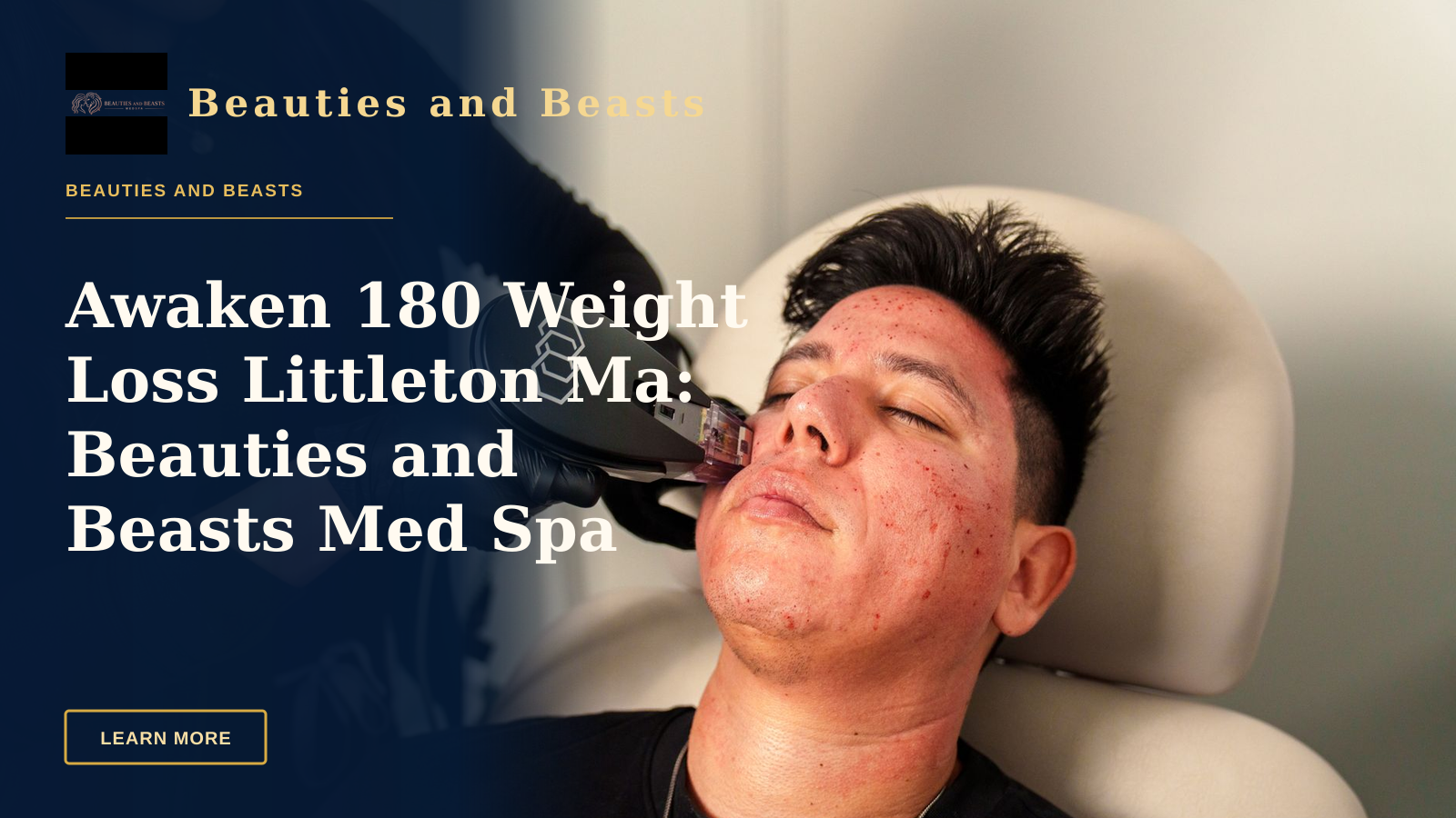 Awaken 180 Weight Loss Littleton Ma: Beauties and Beasts Med Spa