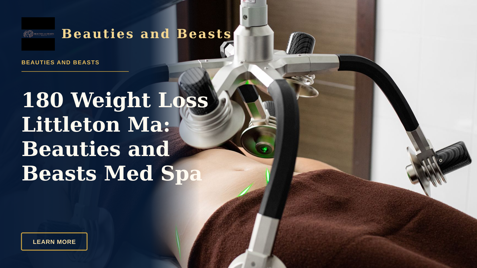 180 Weight Loss Littleton Ma: Beauties and Beasts Med Spa Leads