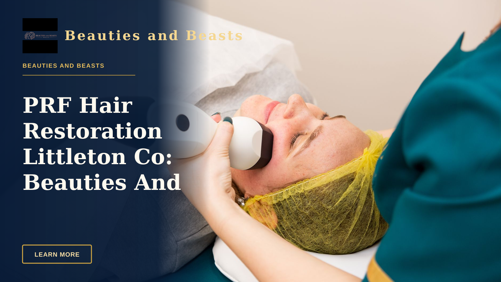 PRF Hair Restoration Littleton Co: Beauties And Beasts Leads — A woman receiving professional facial treatment at a clinic, highlighting beauty and technology.