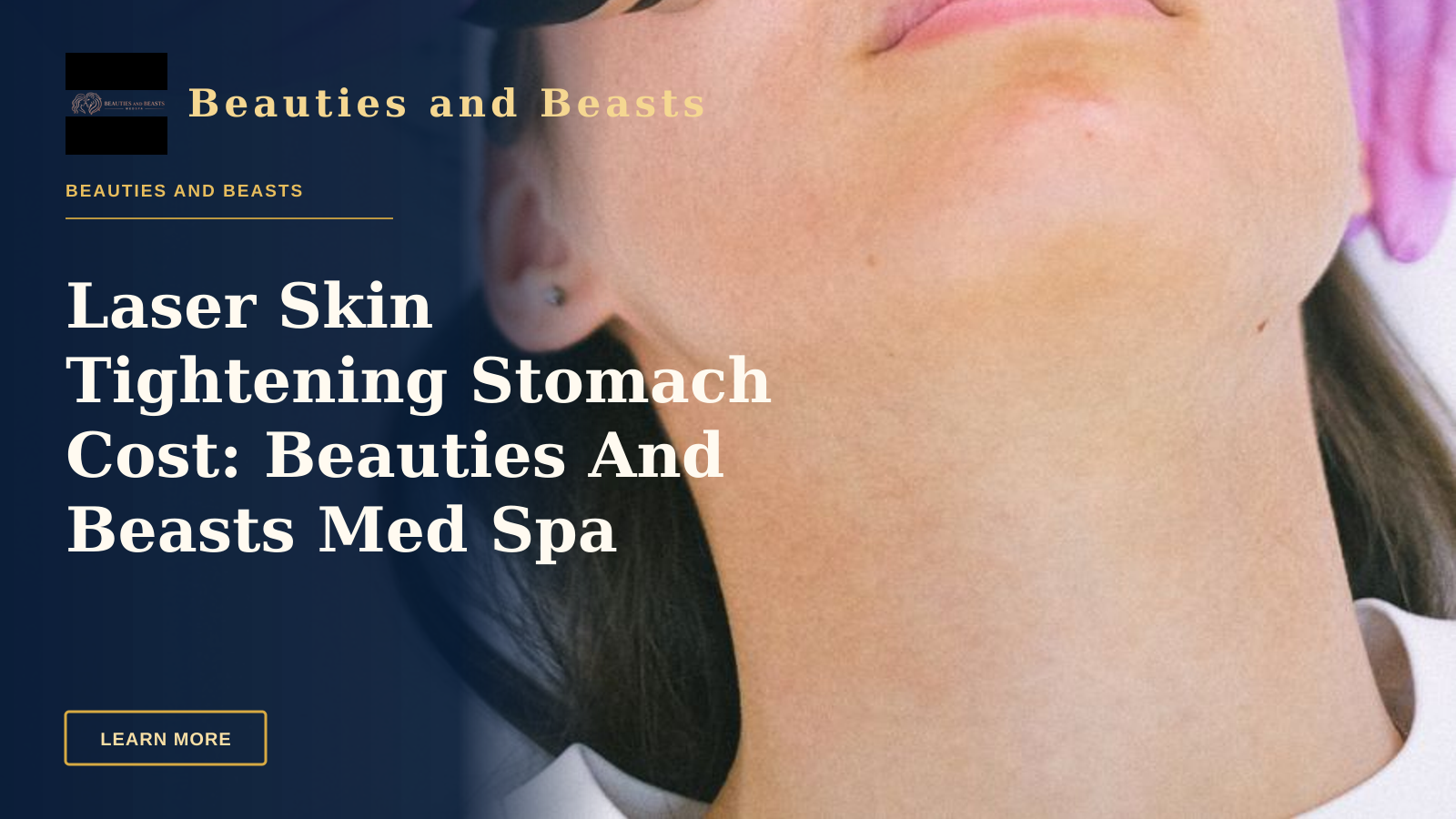 Laser Skin Tightening Stomach Cost: Beauties And Beasts Med Spa