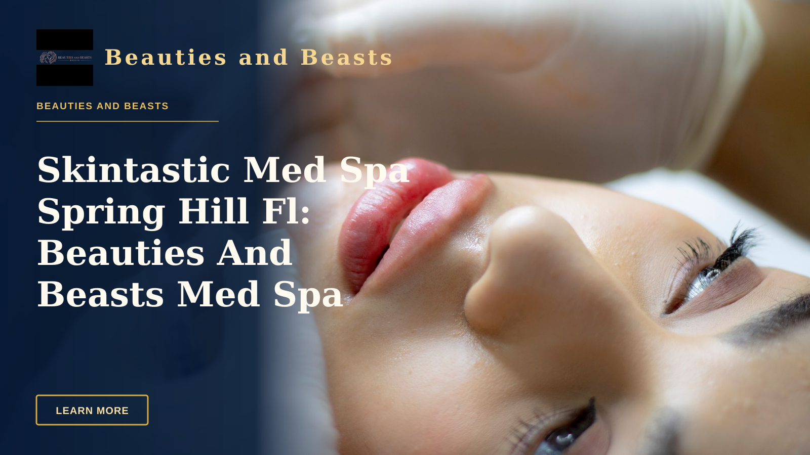 Skintastic Med Spa Spring Hill Fl: Beauties And Beasts Med Spa Leads With Data — Close-up of a woman receiving a lip augmentation with a syringe by a professional.