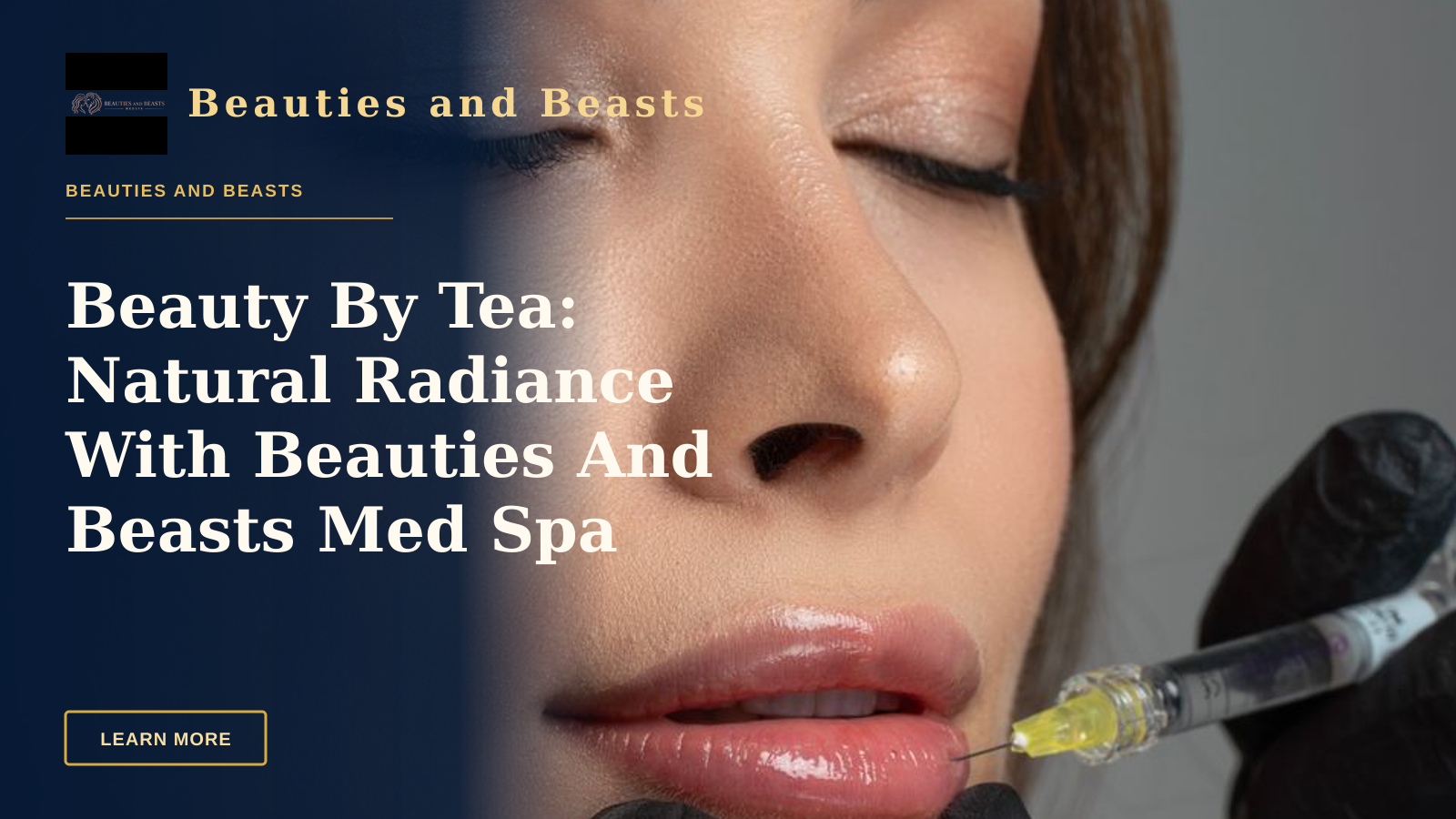 Beauty By Tea: Natural Radiance With Beauties And Beasts Med Spa — A professional administering lip enhancement treatment to a woman with closed eyes, enhancing facial aesthetics.