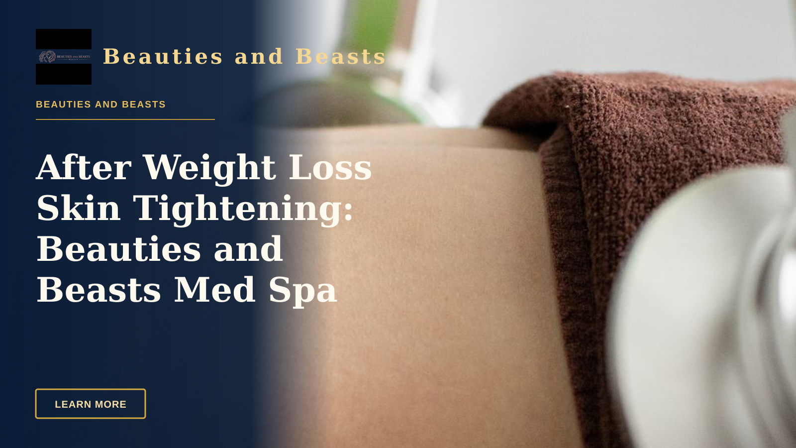 After Weight Loss Skin Tightening: Beauties and Beasts Med Spa