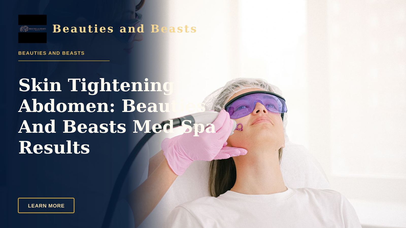 Skin Tightening Abdomen: Beauties And Beasts Med Spa Results
