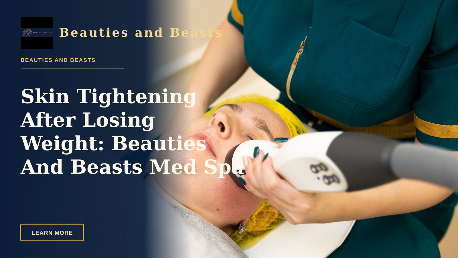 Skin Tightening After Losing Weight: Beauties And Beasts Med Spa