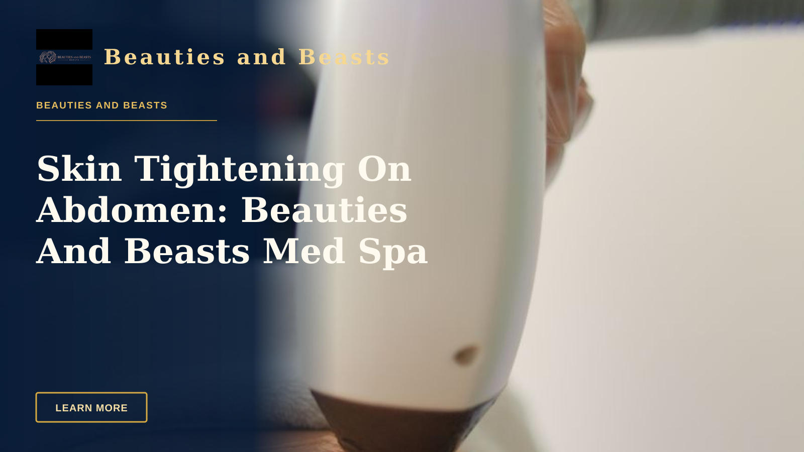 Skin Tightening On Abdomen: Beauties And Beasts Med Spa