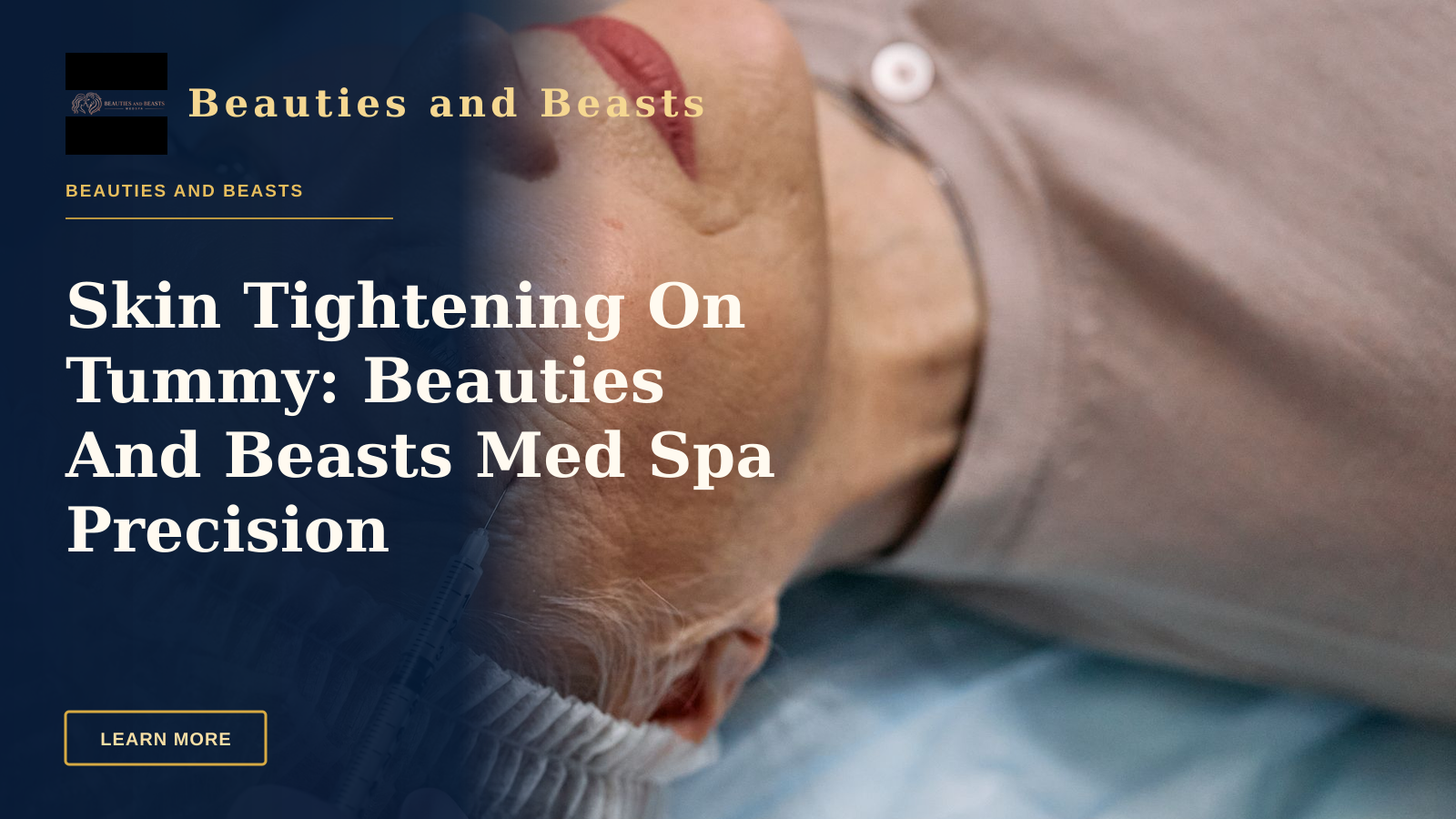 Skin Tightening On Tummy: Beauties And Beasts Med Spa Precision