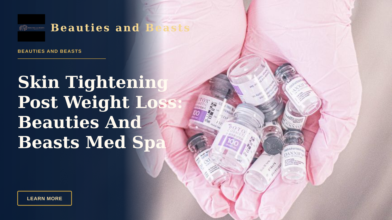 Skin Tightening Post Weight Loss: Beauties And Beasts Med Spa